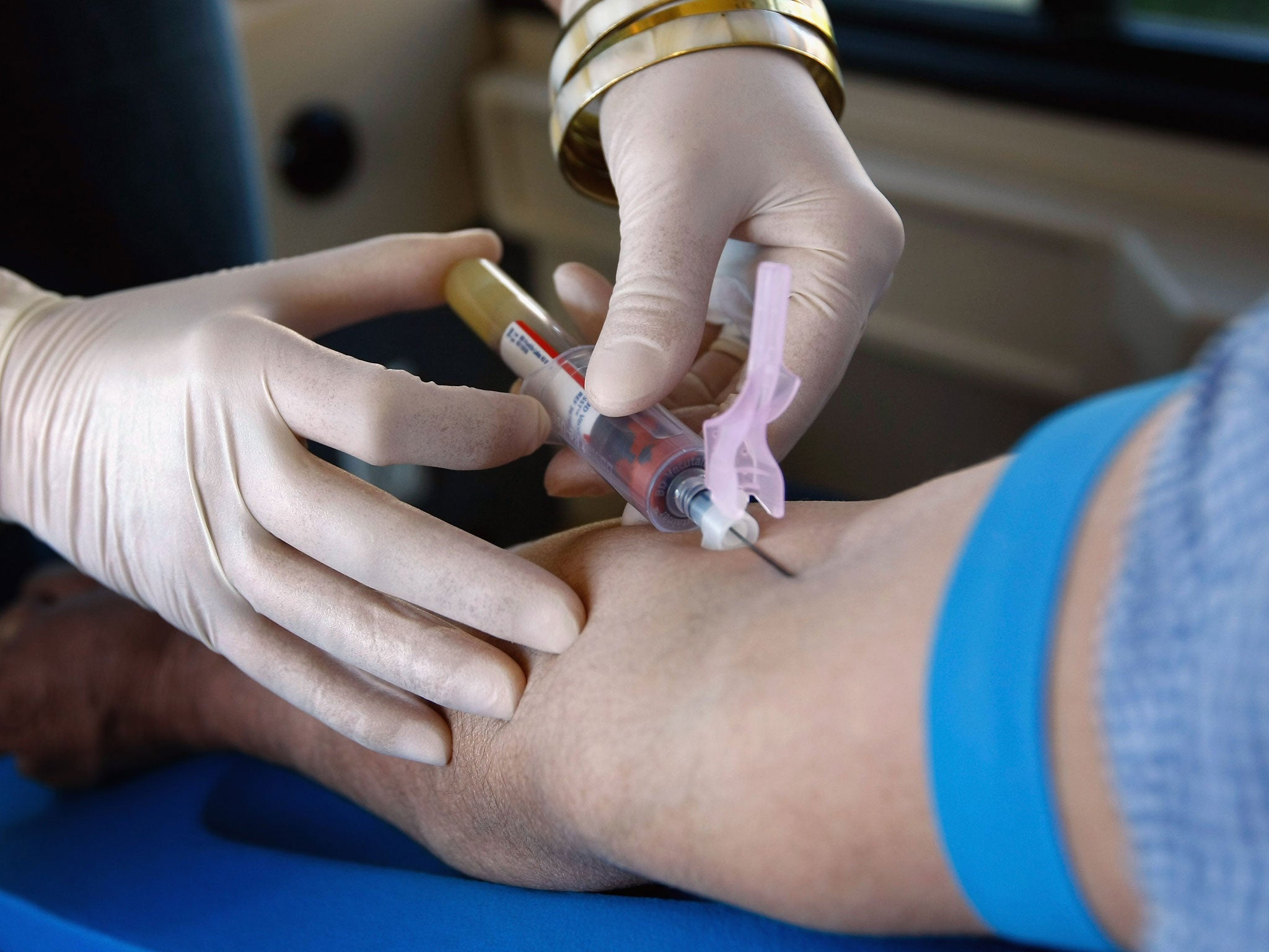 Scientists have shown that an infusion of young blood can reverse signs of ageing