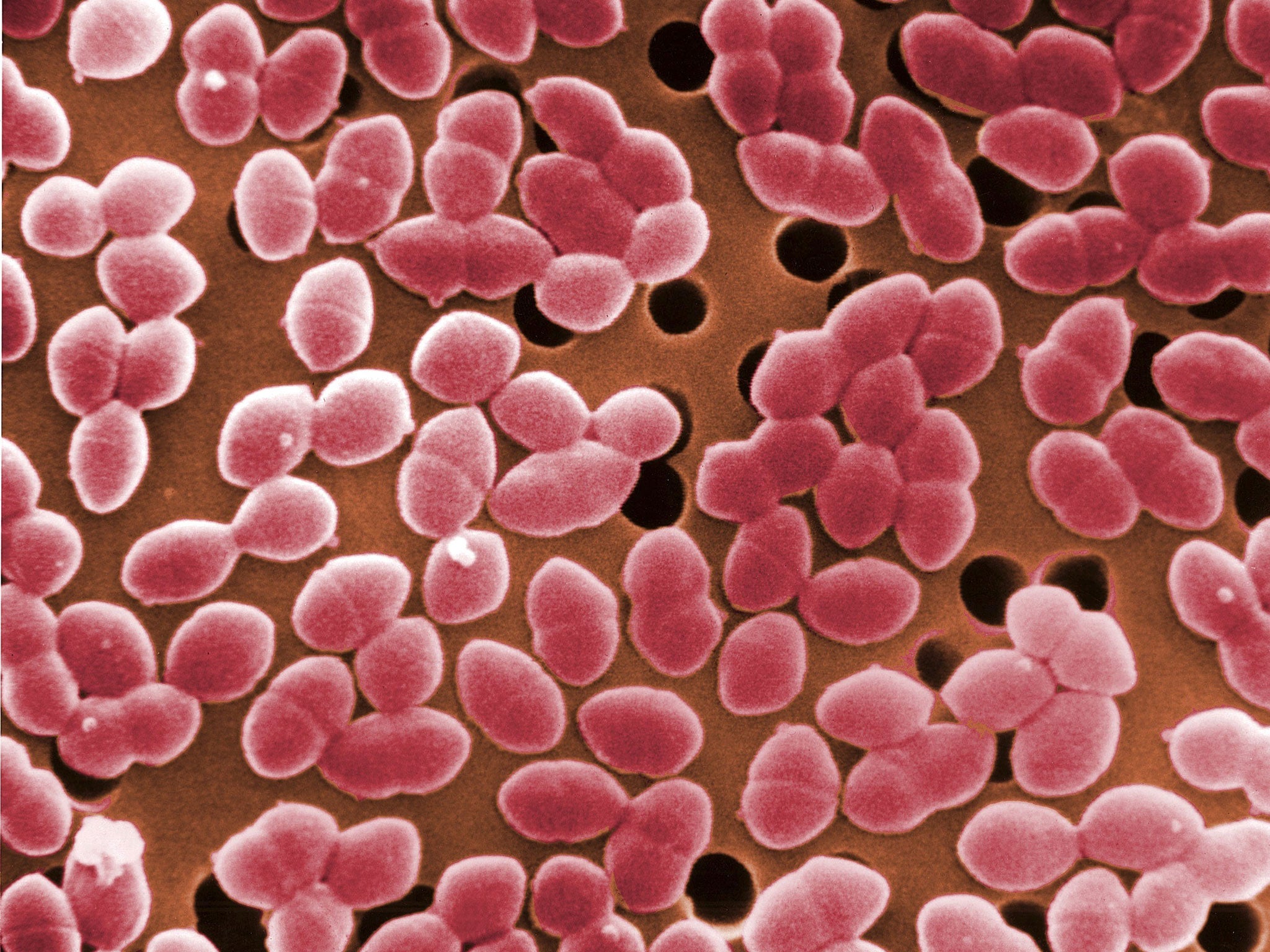 File: A scanning electron micrograph (SEM) image of Enterococcus faecalis (formerly known as Streptococcus faecalis), a bacterium commonly found in the human intestine but which can also cause urinary tract and skin infections