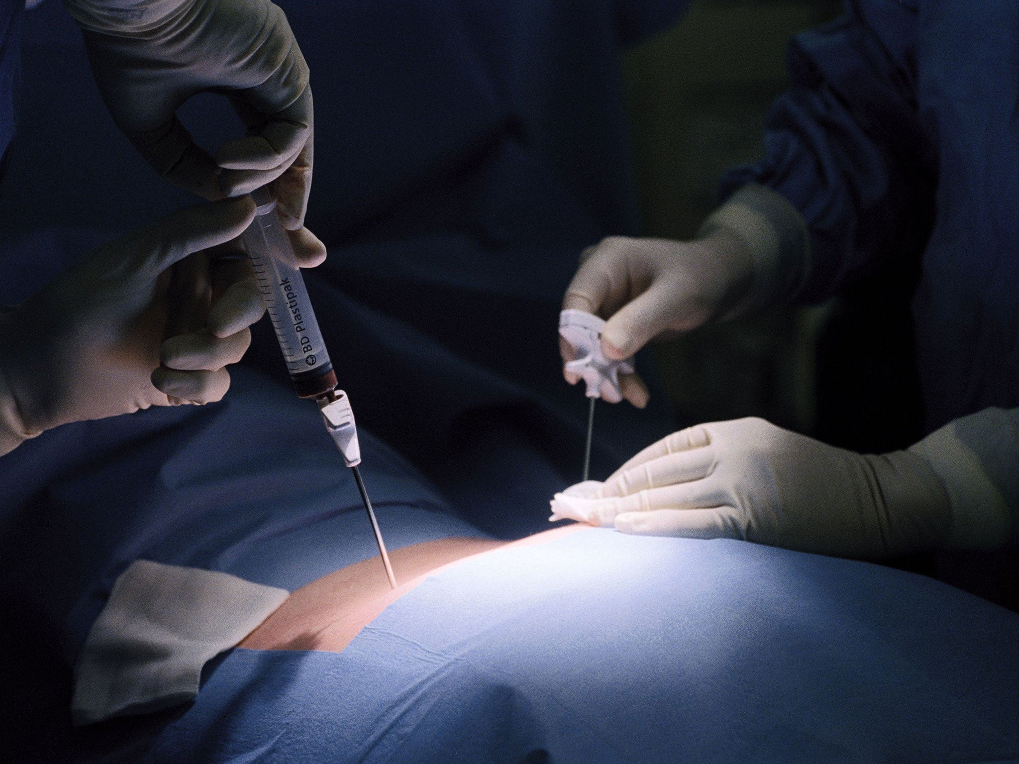 File: Doctors perform a bone marrow transplant operation on a patient under general anaesthetic