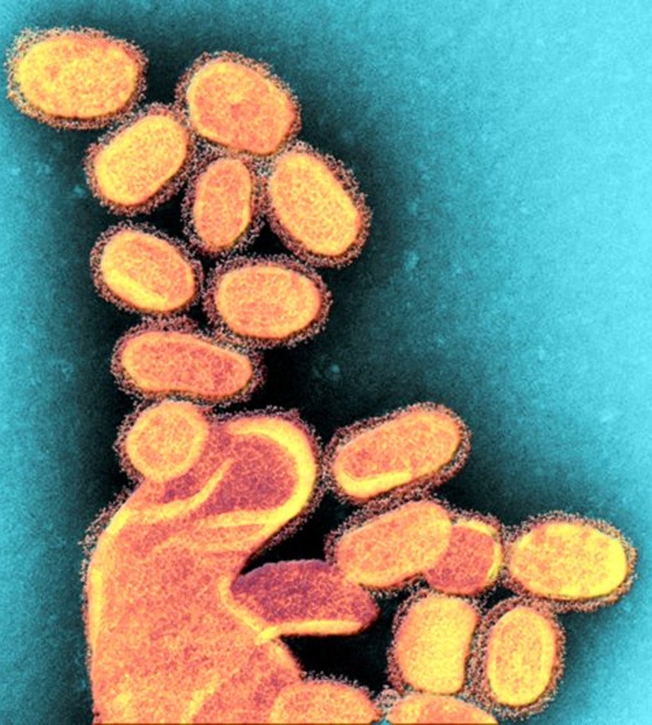 The H1N1 1918 influenza virus. These particles have been recreated from the influenza (flu) virus strain that caused the 1918 Spanish flu pandemic