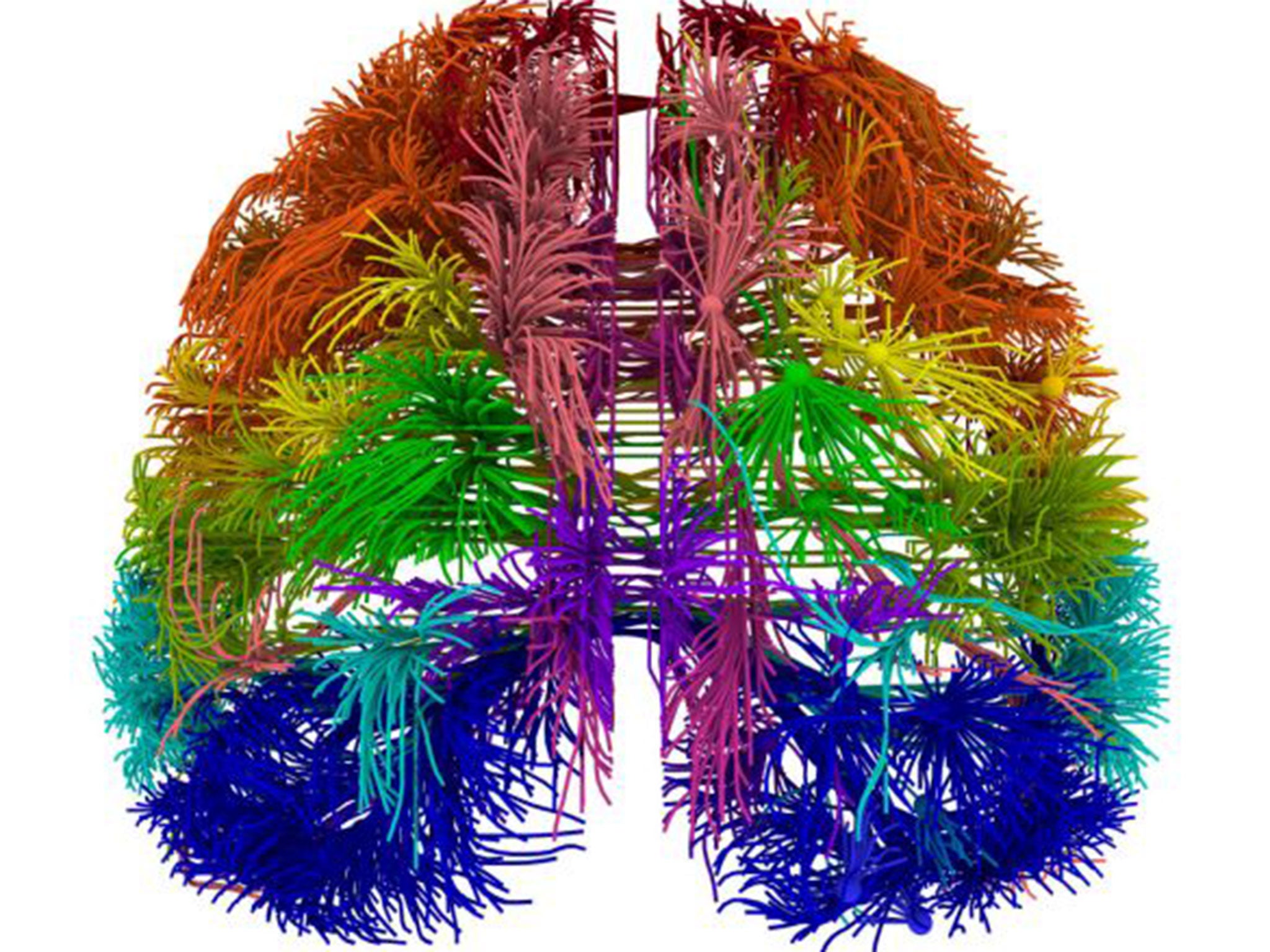 Brain teaser: Modelling a patient’s bloodflow on a supercomputer could throw up ethical dilemmas