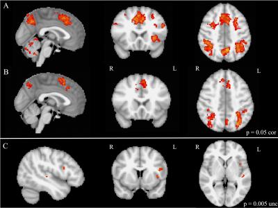 This image shows functional MRI imaging during mental task switching: Panels A and B shows brain activation in musically trained and untrained children, respectively. Panel C shows brain areas that are more active in musically trained than musically untrained children