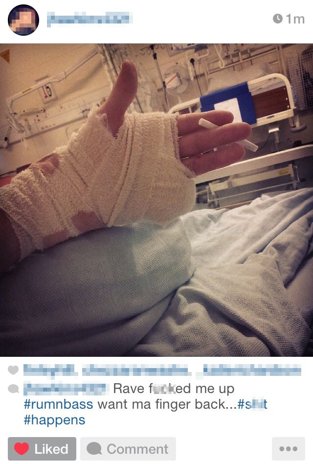 Josh posted a picture of his injury on Instagram