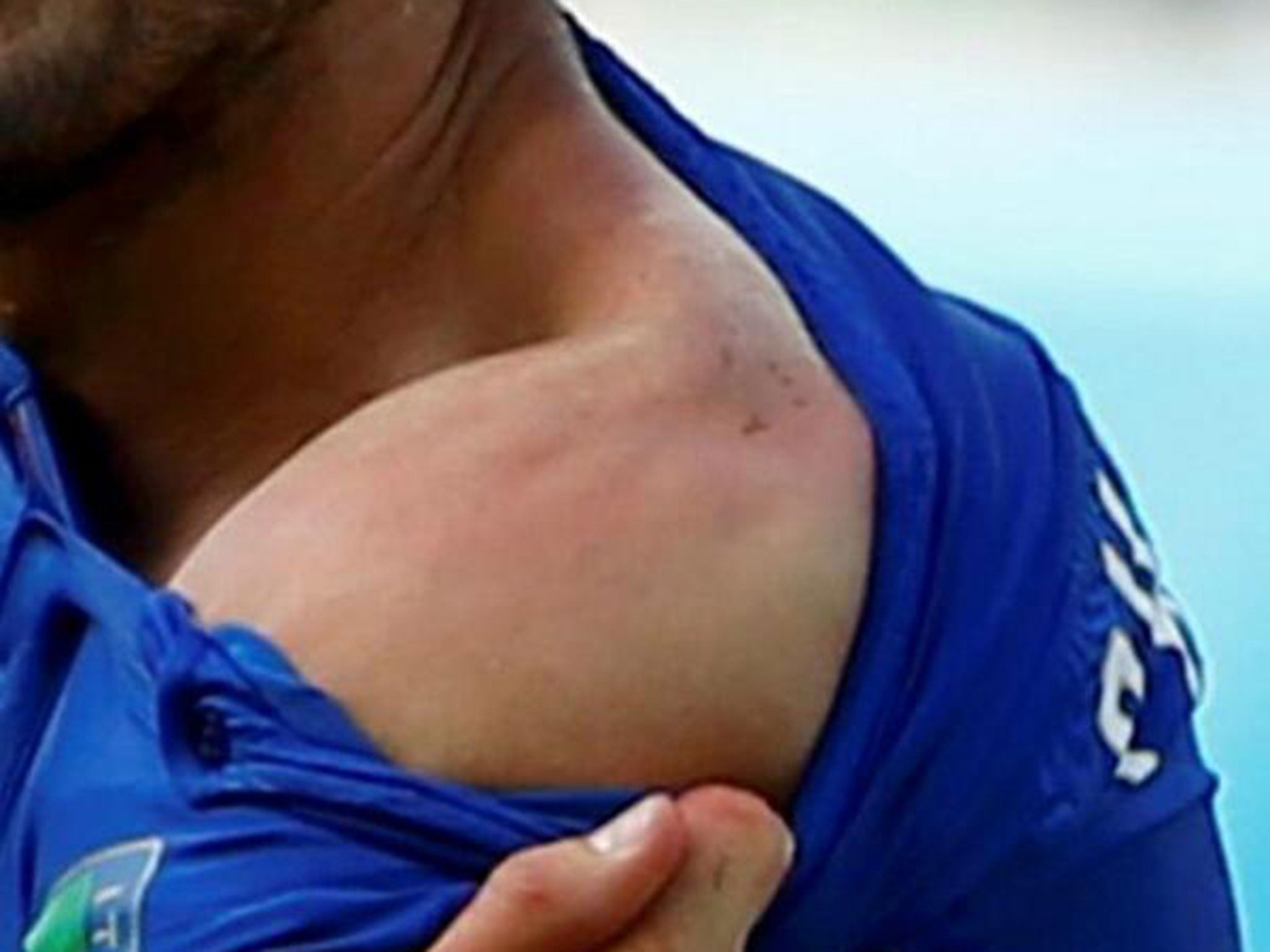 Giorgio Chiellini shows his shoulder in which he accused Luis Suarez of biting him