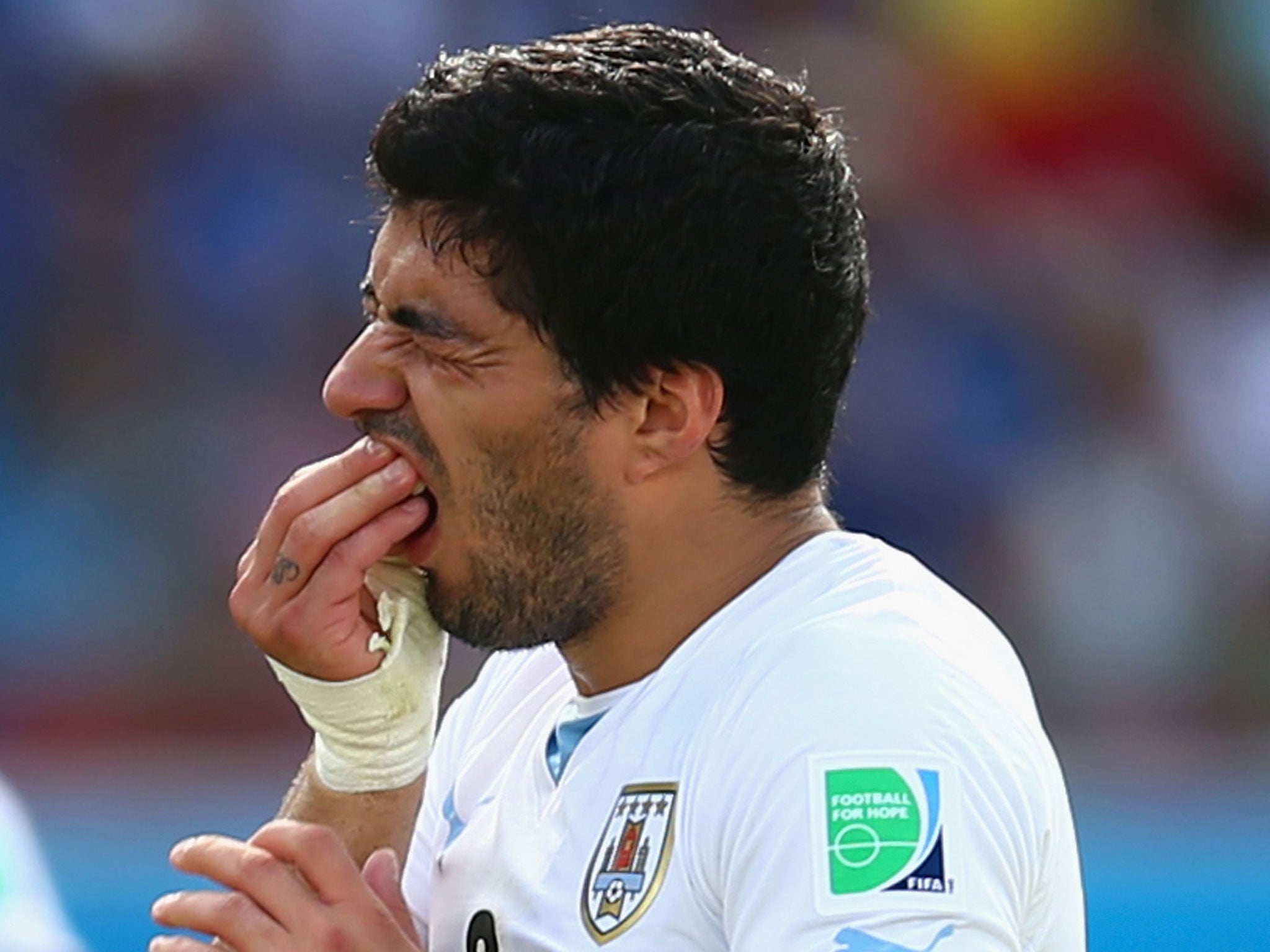 Suarez holds his teeth after colliding with Chiellini