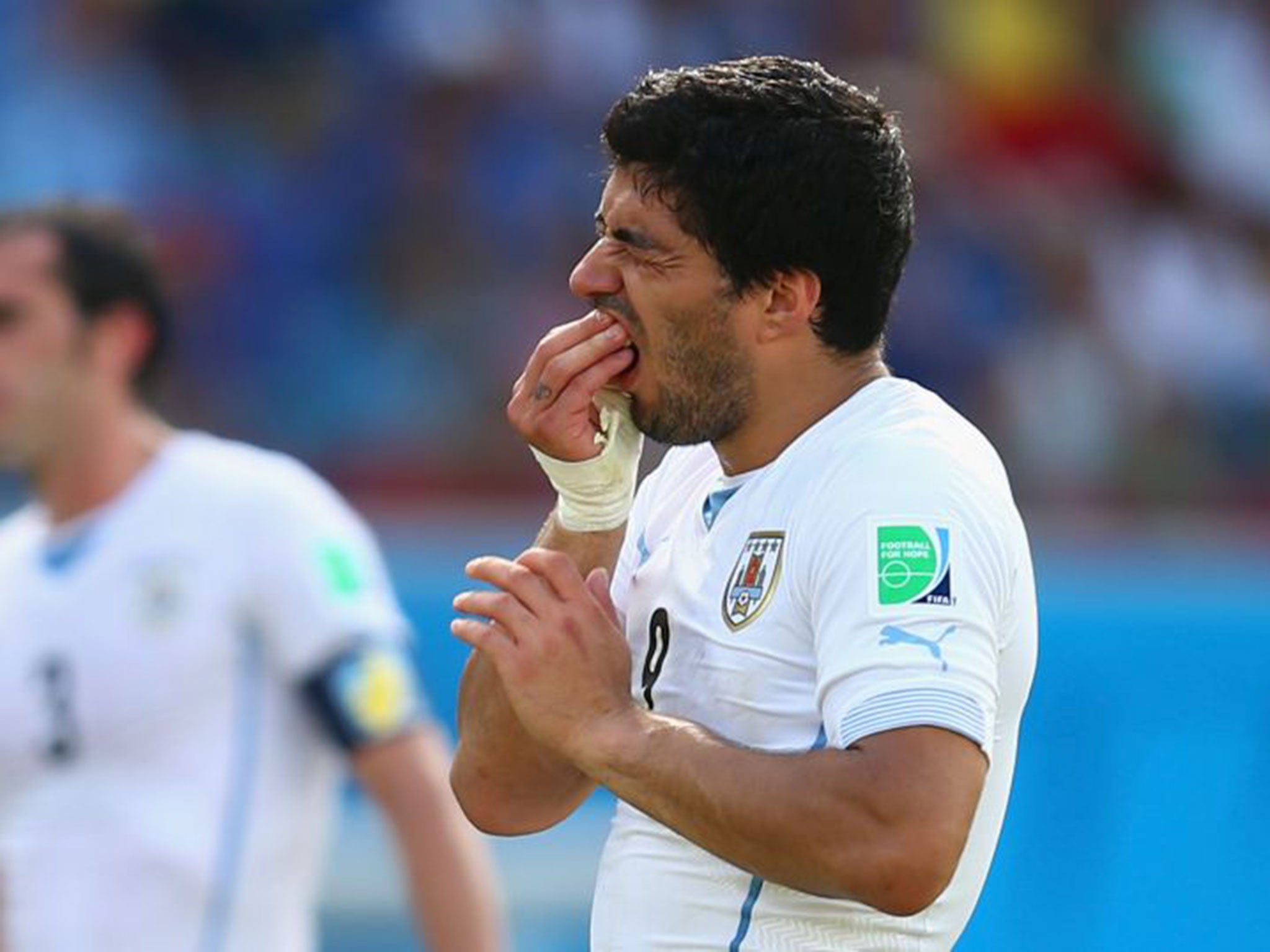 Suarez holds his teeth after biting Chiellini