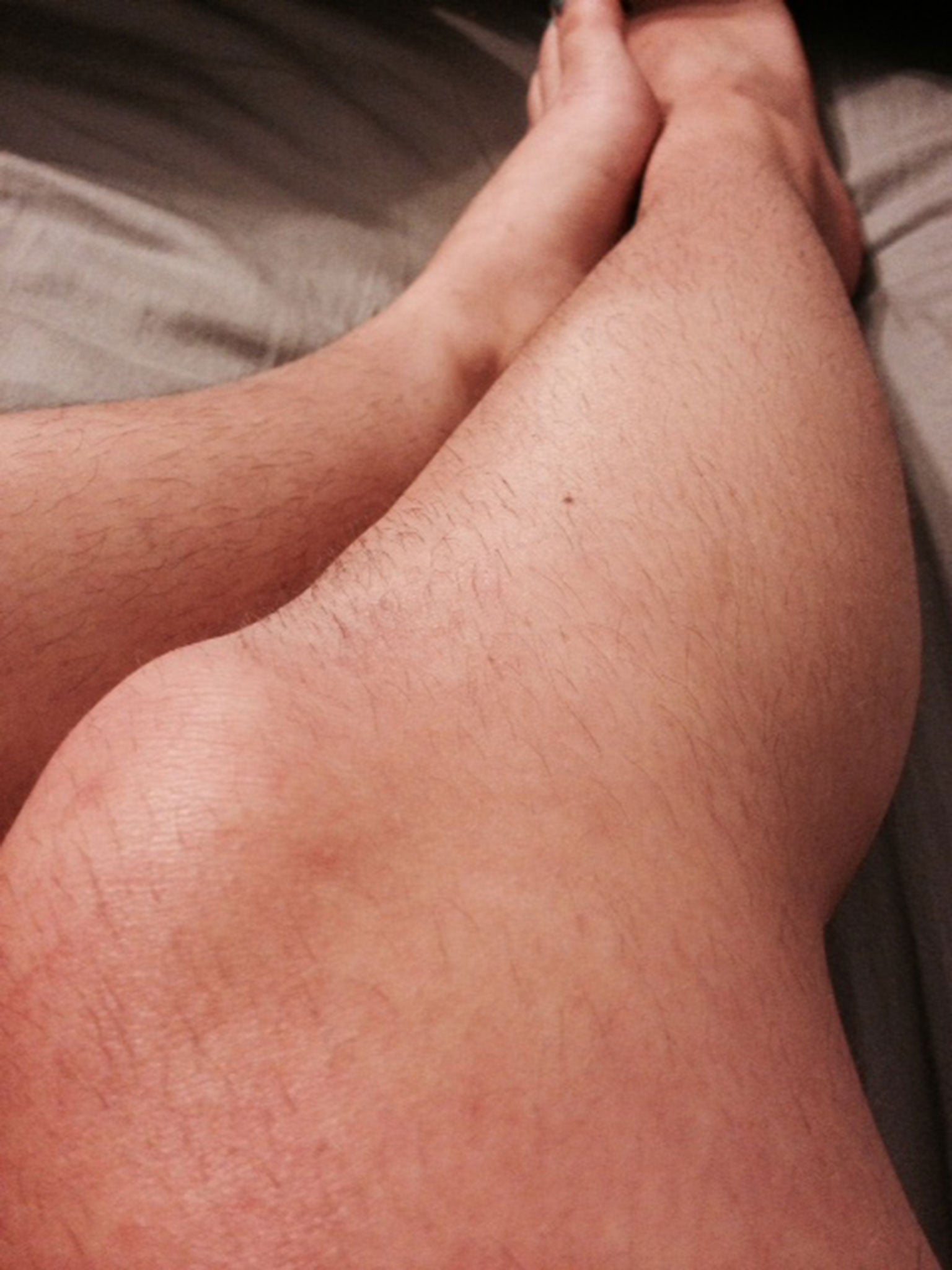 A submission to the Hairy Legs Club Tumblr