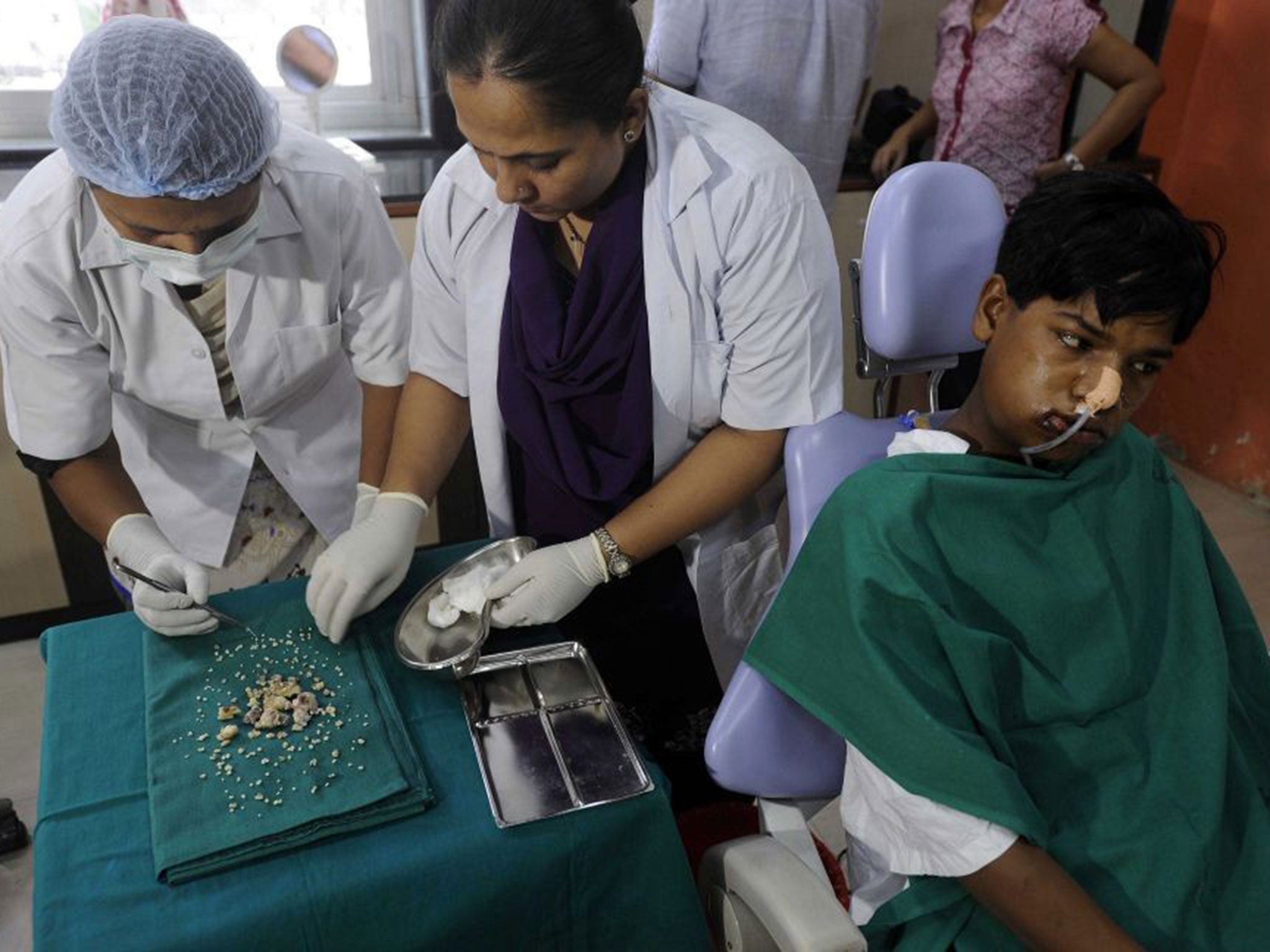 Indian dentists display teeth removed after operating on seventeen year old Ashik Gavai at JJ Hospital in Mumbai.