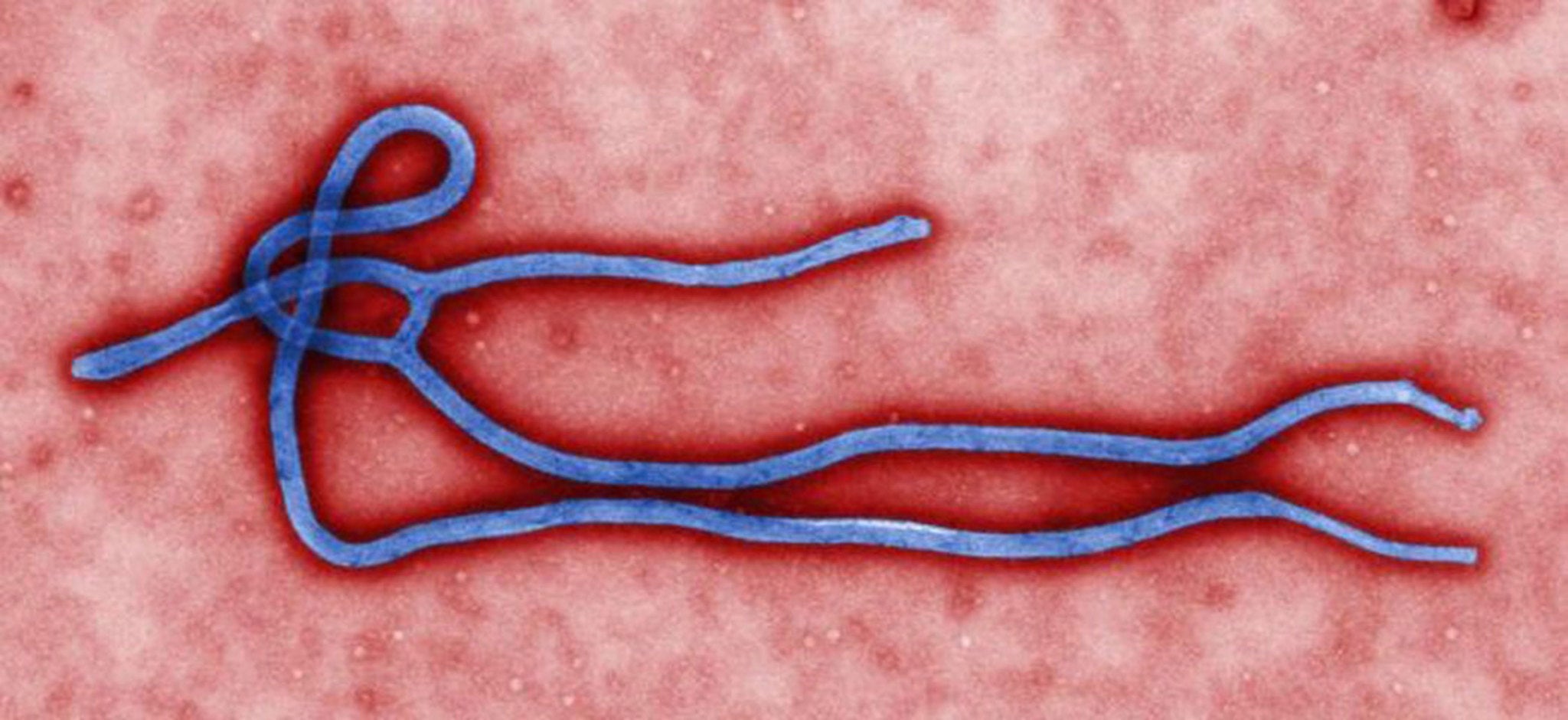 Fear and loathing: an Ebola virus; the disease has now spread to Liberia and, for the first time, Sierra Leone and Nigeria,