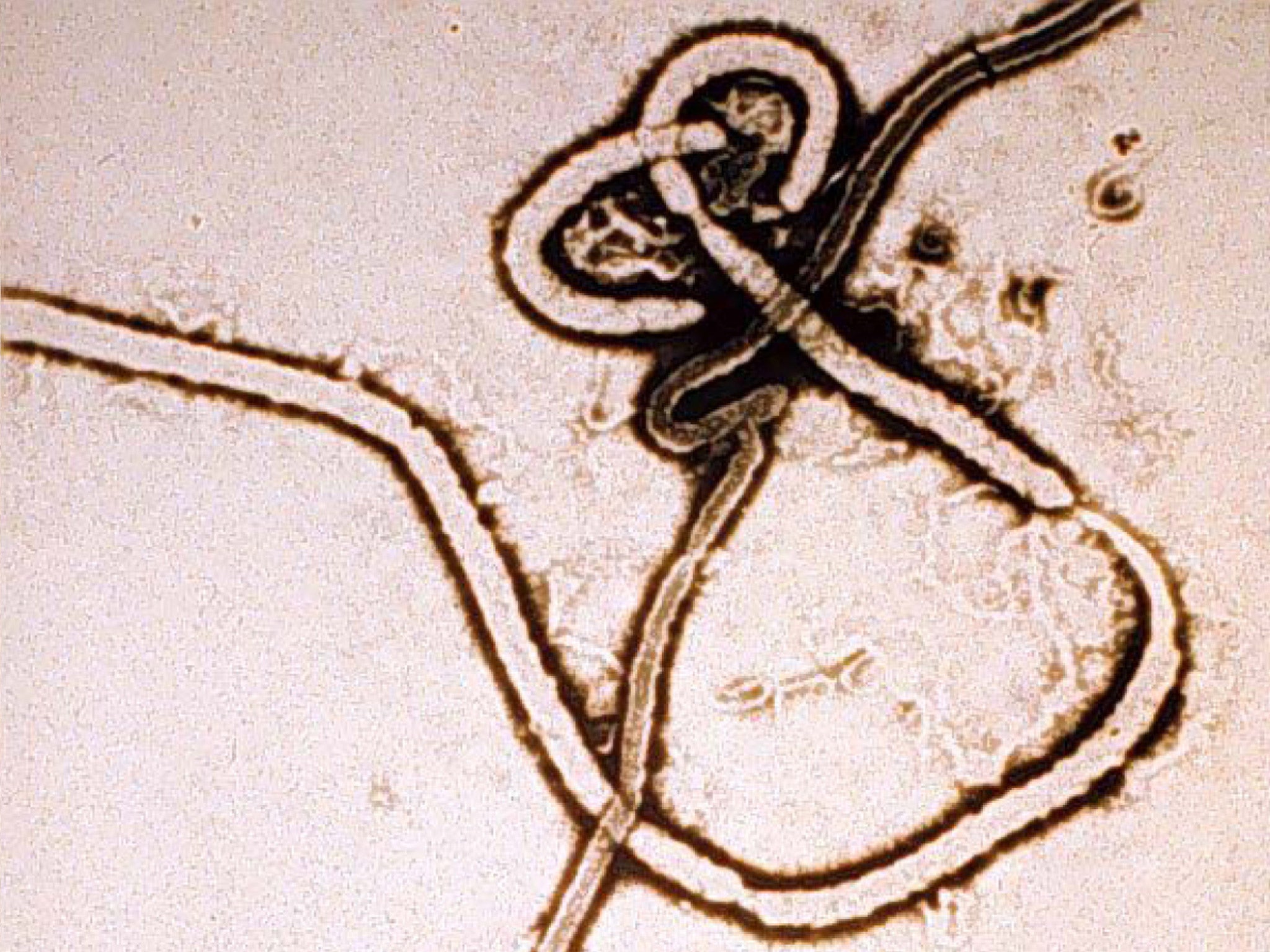 An electron micrograph of the Ebola virus