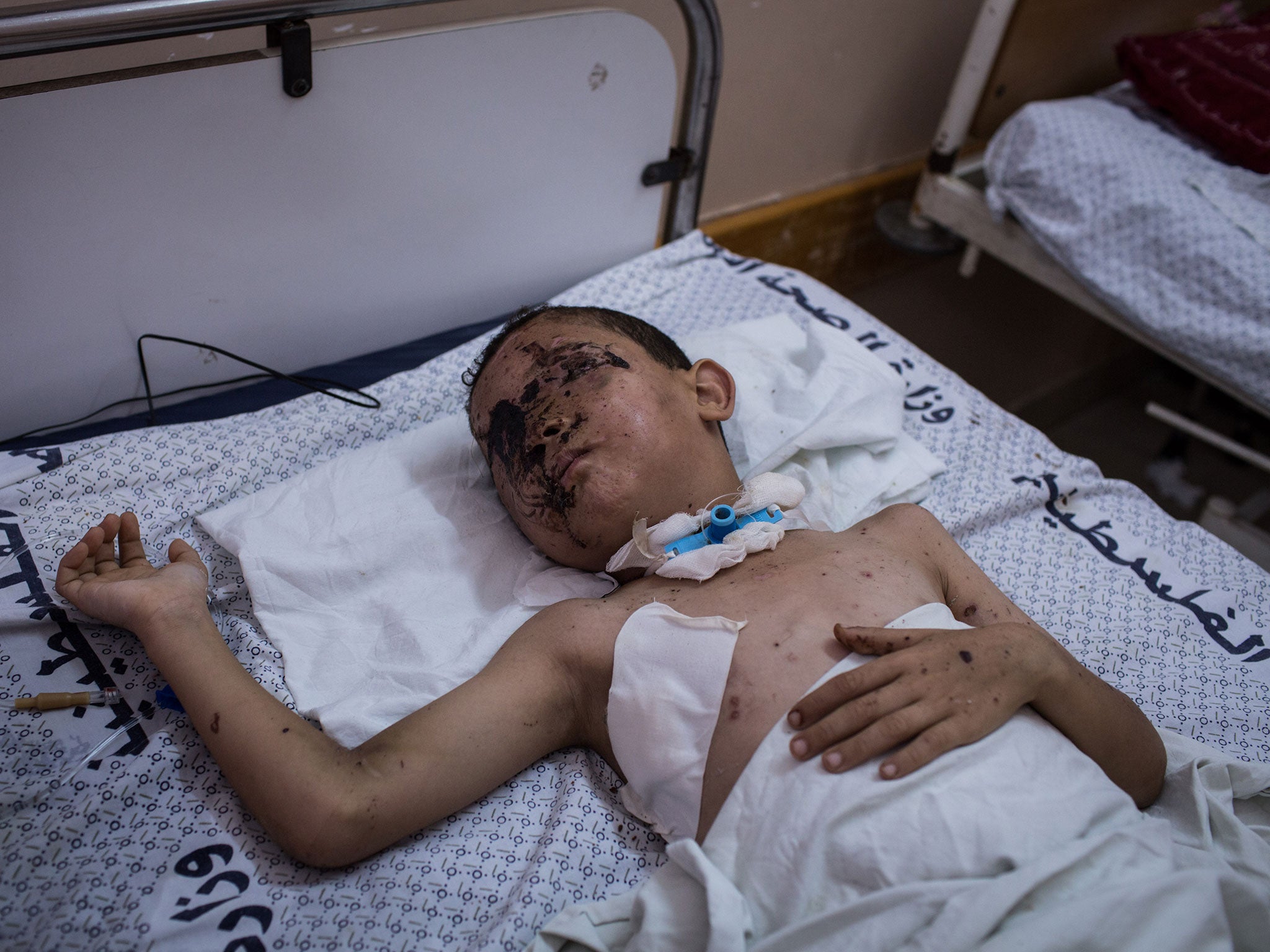 Mohammed Badran, 8, who was severely injured when his family's home in Nuseirat was bombed, lies in a hospital bed in Shifa Hospital, Gaza. Mohammed was blinded in the attack and needs complex reconstructive surgery only available outside Gaza