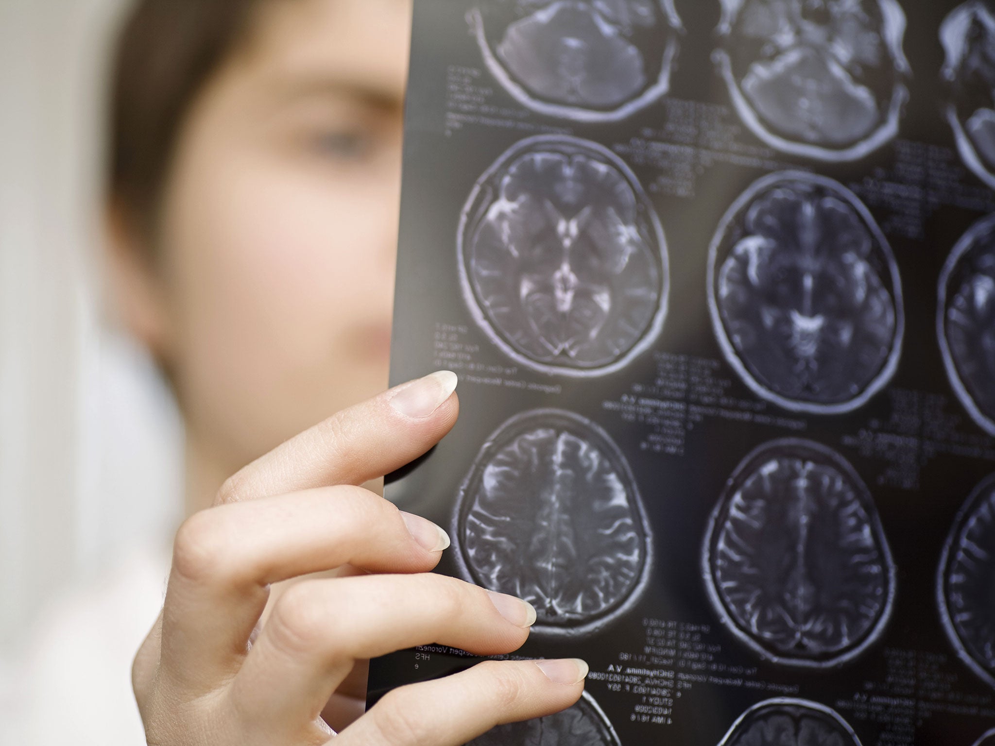 A doctor looks at a brain scan