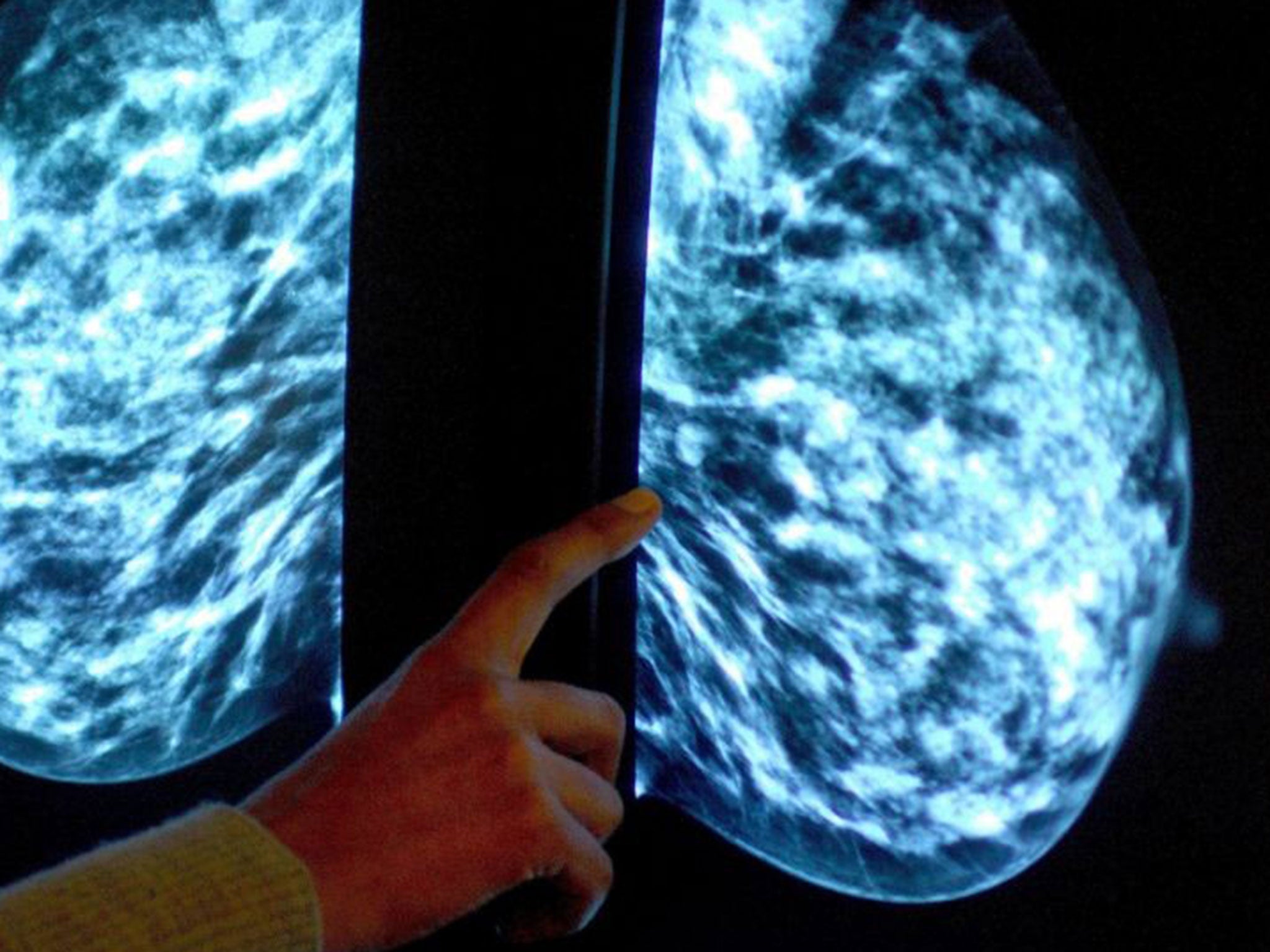 A doctor inspects a mammogram