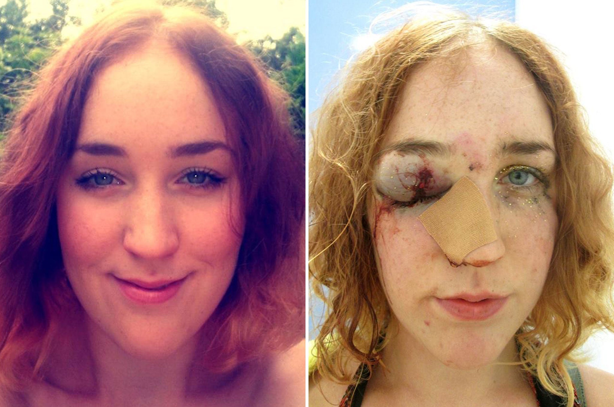 Before and after: Mary Brandon's Facebook profile picture (left), and the image taken after she was hit