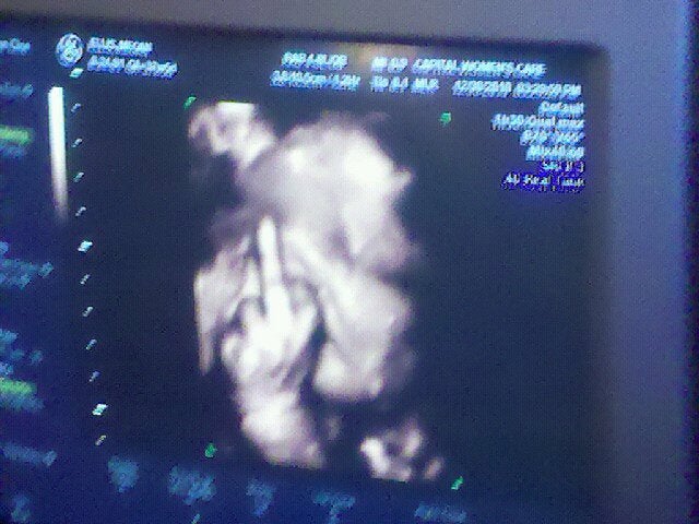 (Picture: jamblaell)