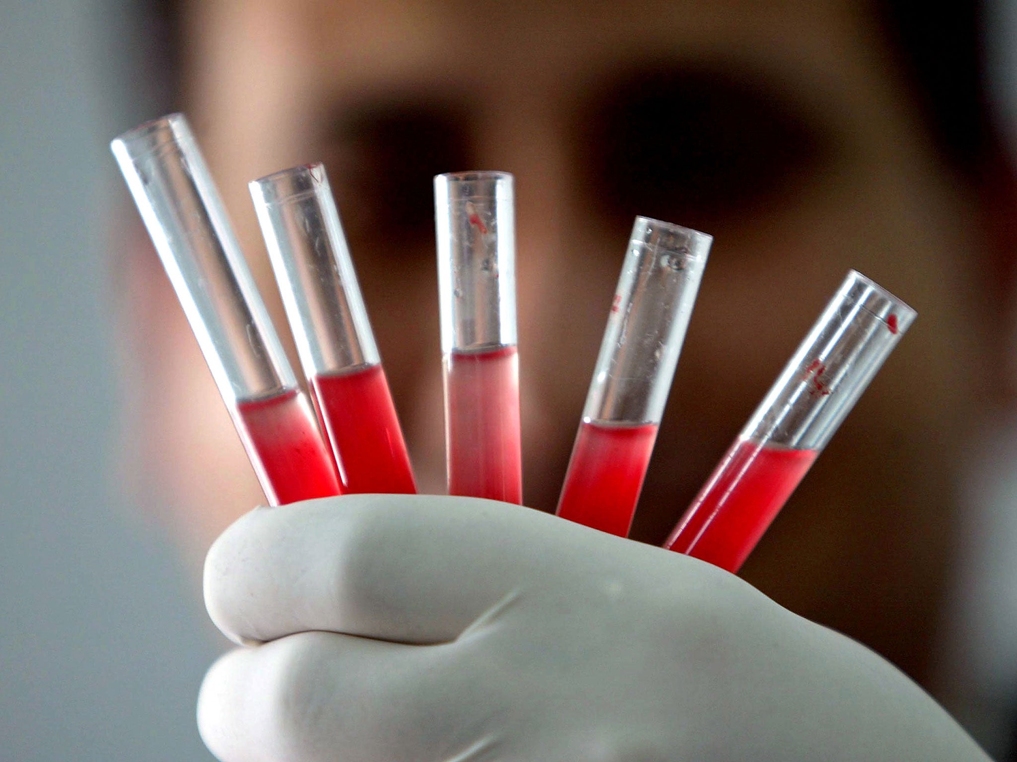 A Palestinian laboratory worker checks blood units donated by members of the Palestinian public at Shifa hospital in Gaza City.