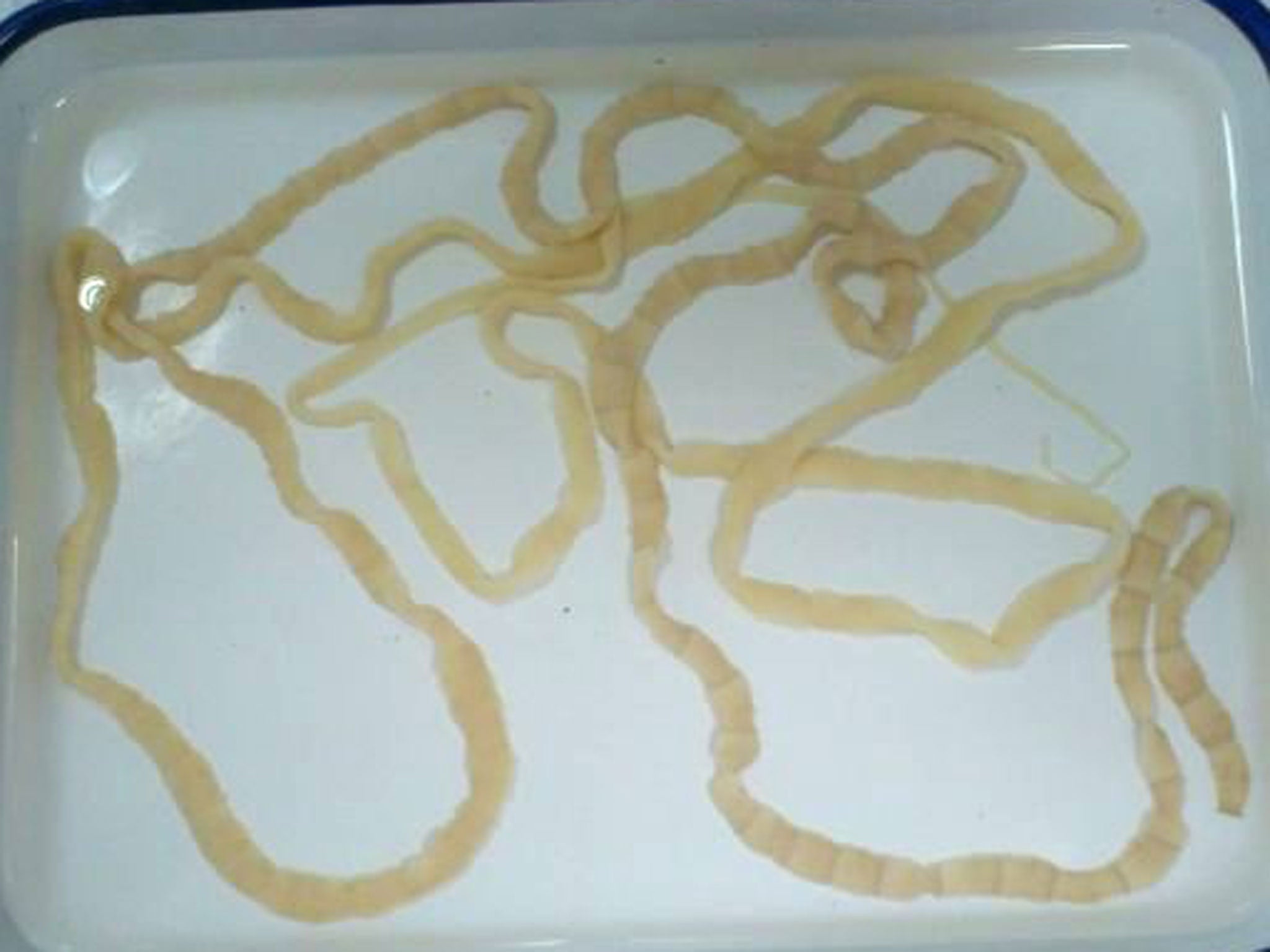 An example of an tapeworm