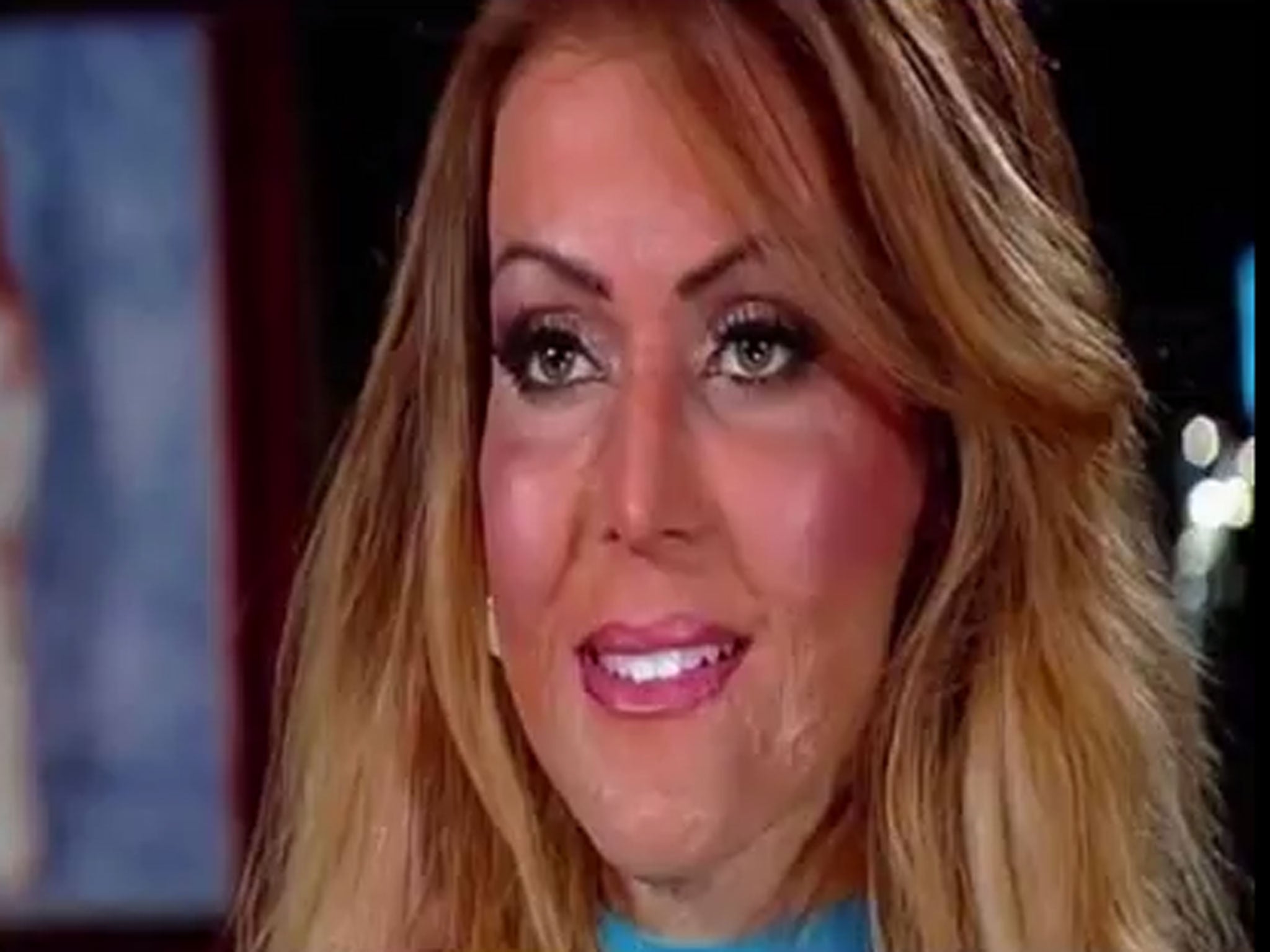 Dana Vulin reveals her new face following the horrific attack two and a half years ago