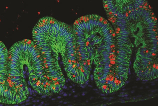 A cross section of miniature stomach grown in lab, stained to show the various cells found in human stomachs.