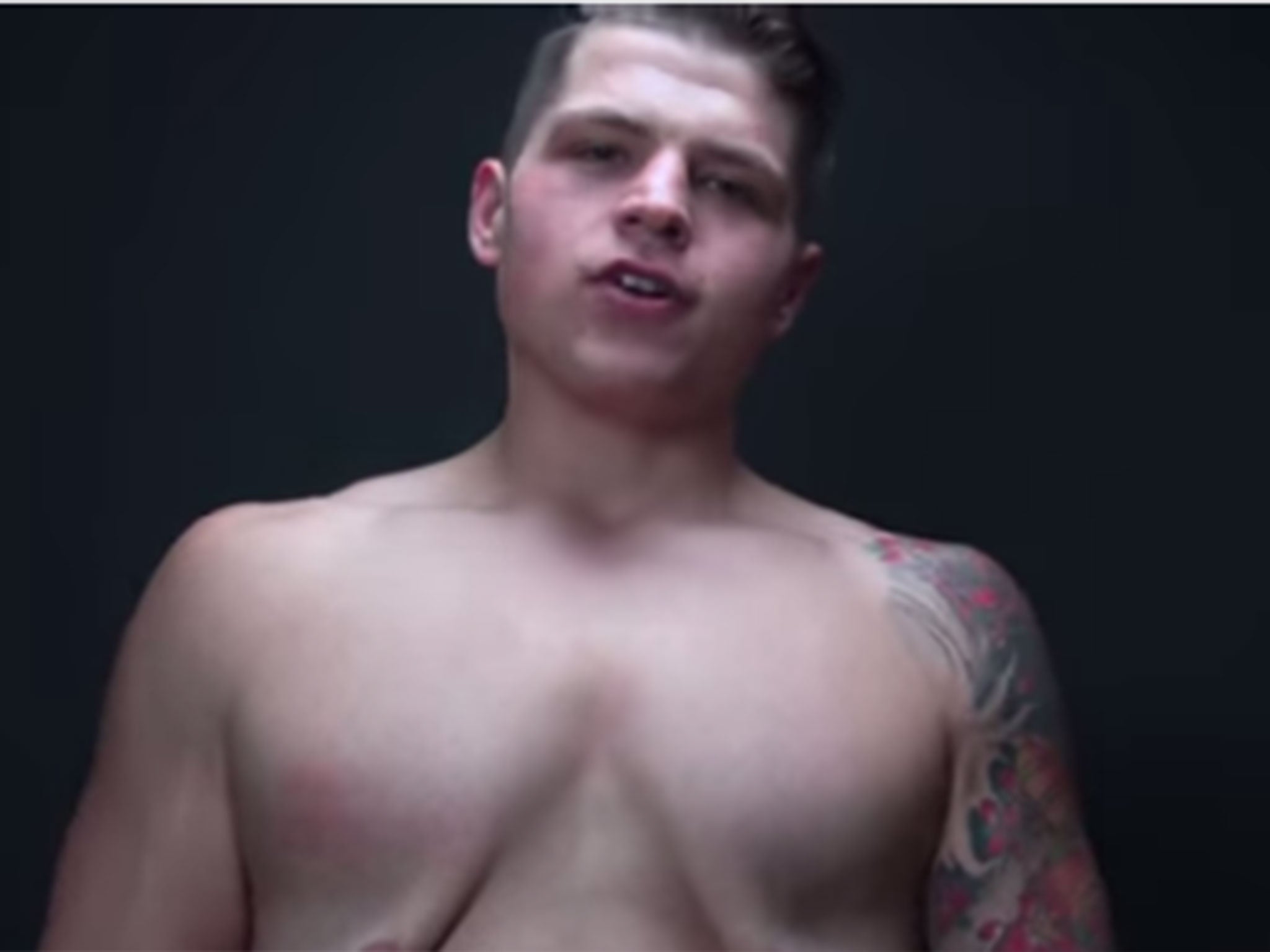 Man loses 160 pounds but still struggles with his biggest insecurity: excess skin.