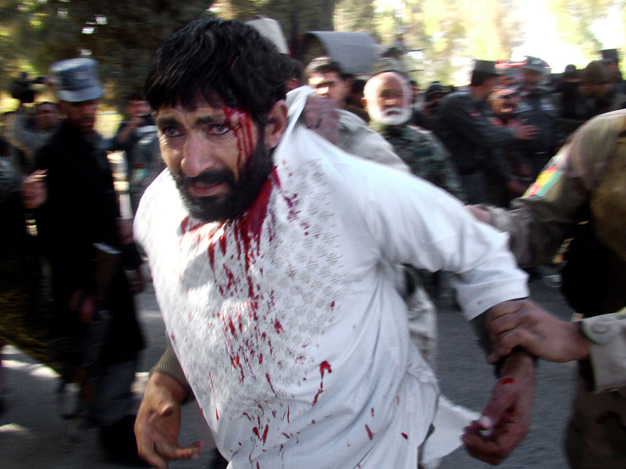 A wounded Afghan man is helped by security personnel as he survives clashes between Afghanistan's forces and insurgents at a branch of Kabul Bank in Lashkargah, capital of Helmand province, Afghanistan
