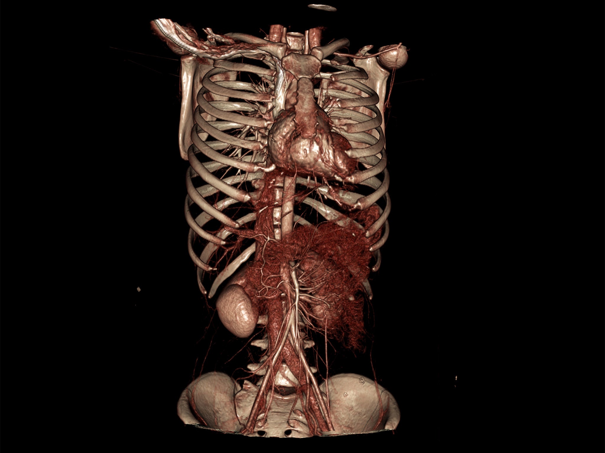 iGene can perform postmortems using detailed digital images