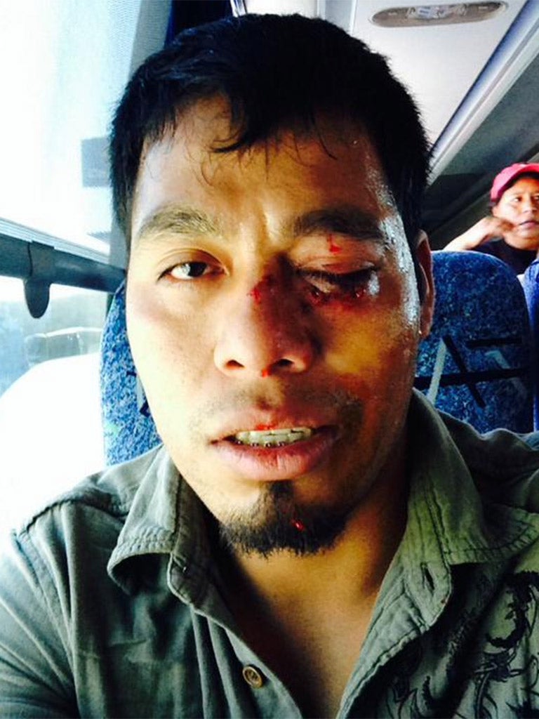 Omar Garcia said military police beat him as he tried to enter an army base last week