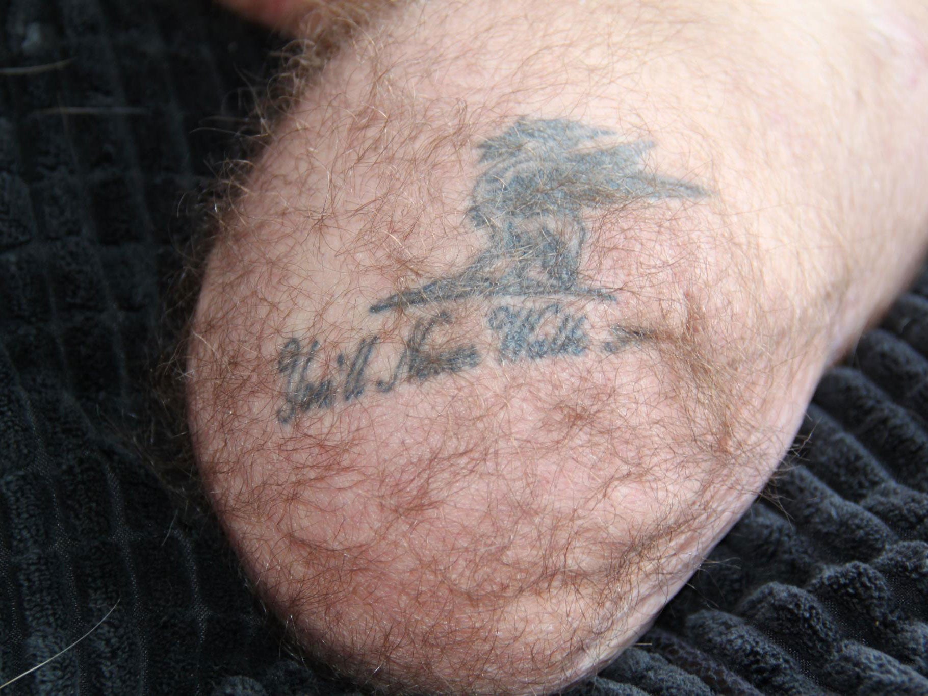 After his right leg was amputated, Andy's Liverpool FC tattoo read ‘You'll Never Walk’