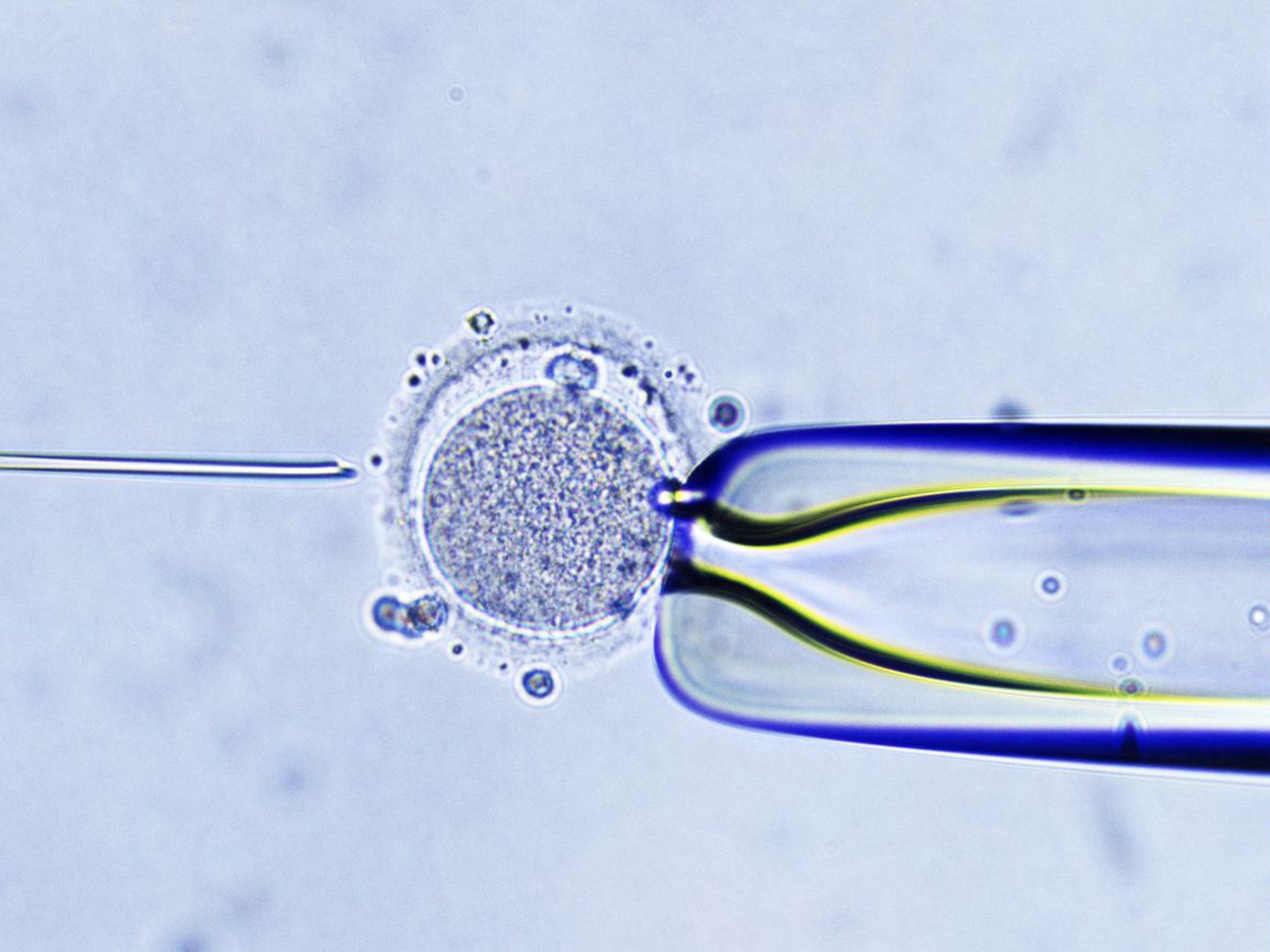 Mitochondrial donation involves the merging of three people’s DNA into a single embryo (Rex)