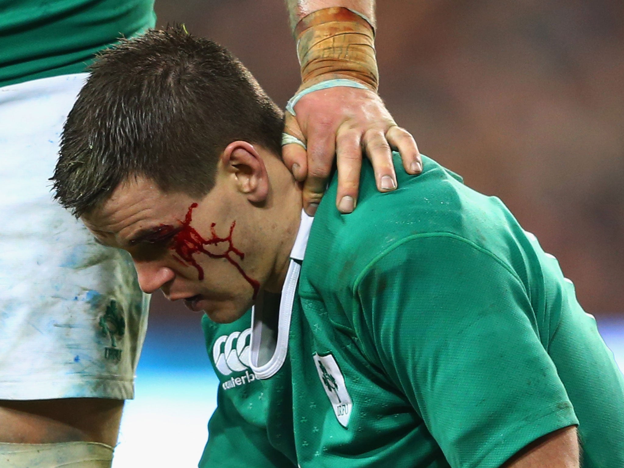 Jonathan Sexton bleeds from a cut during Ireland's 18-11 victory over France