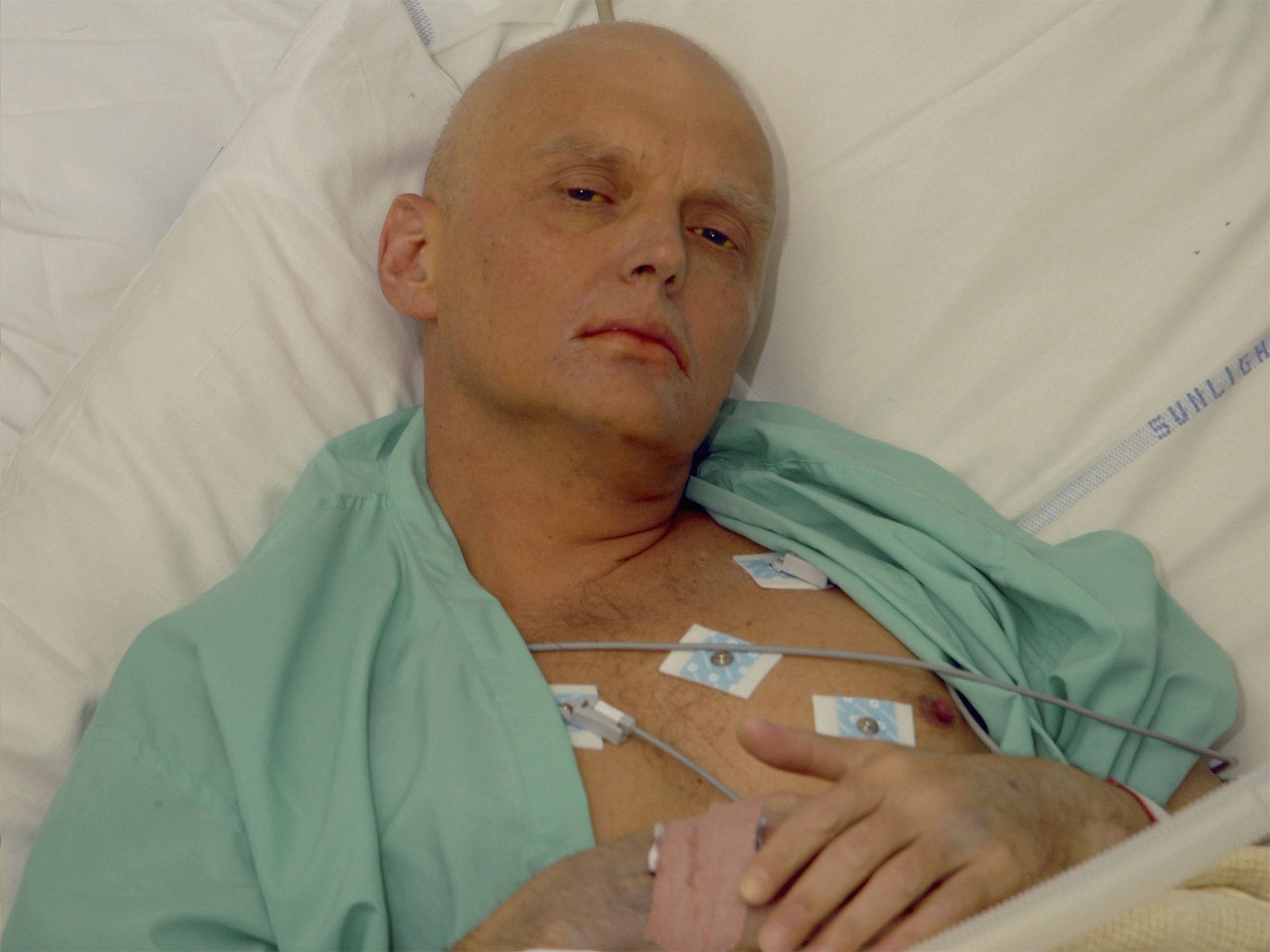 The picture of a dying Alexander Litvinenko publicised by Alex Goldfarb (Getty)