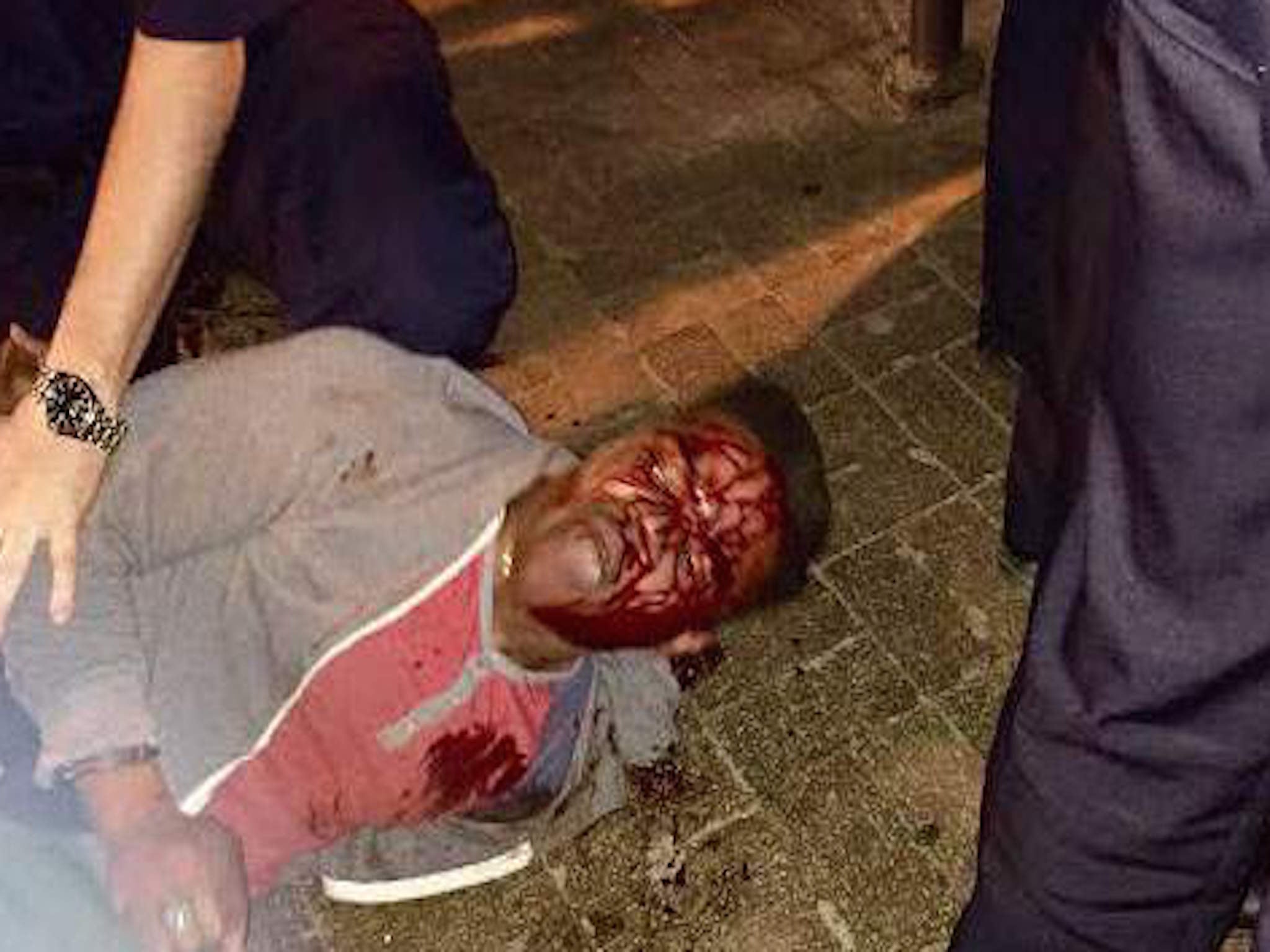 Martese Johnson