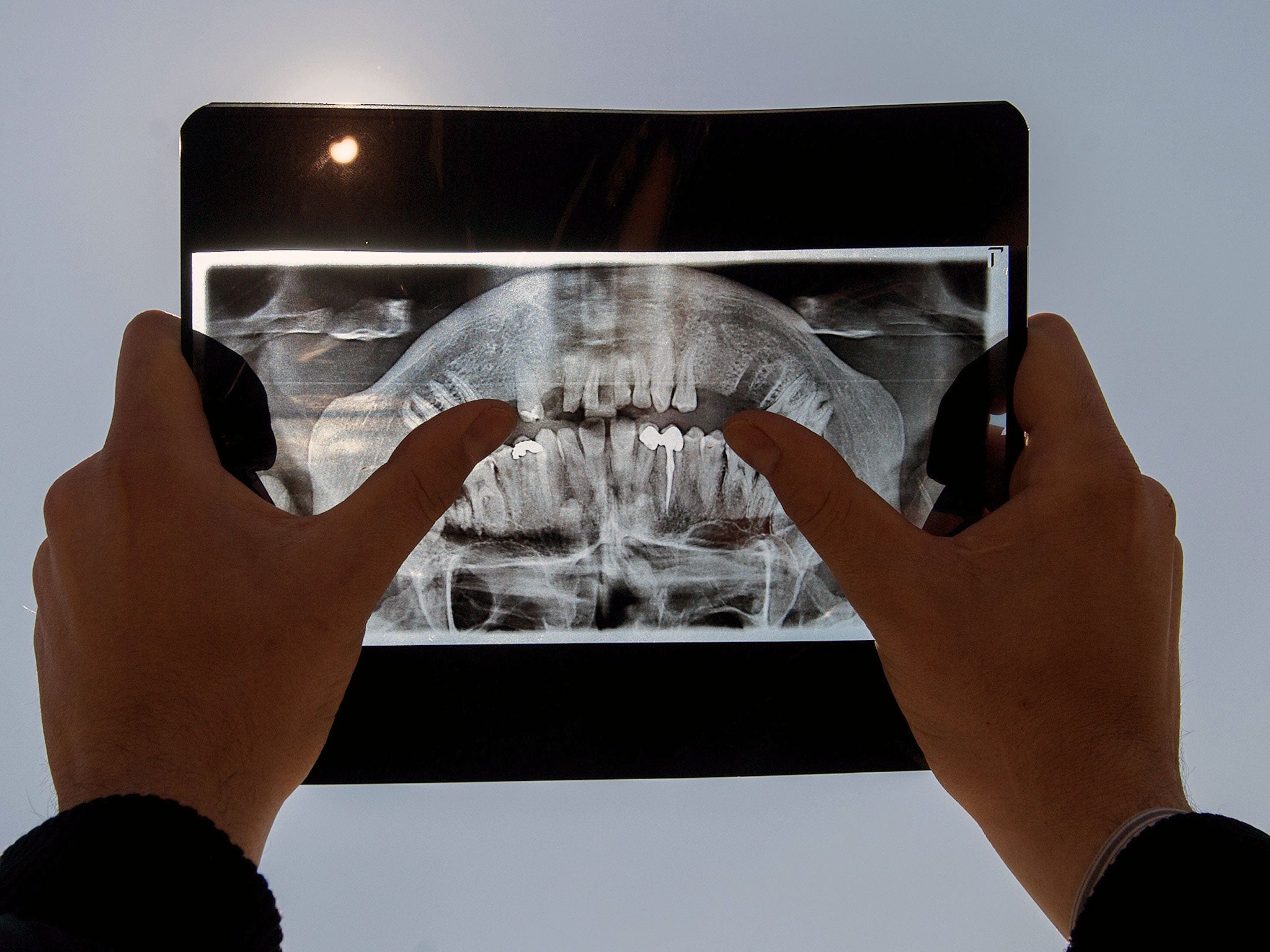 A man uses a dental X-ray to watch a partial solar eclipse in Pristina, Kosovo