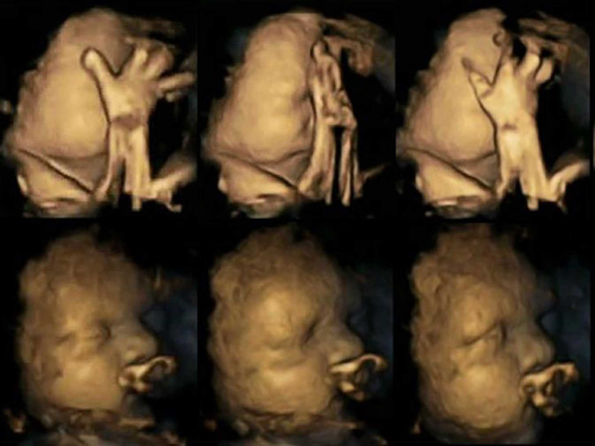 The scans show differences in movement ebtween foetuses of smoking and non-smoking mothers