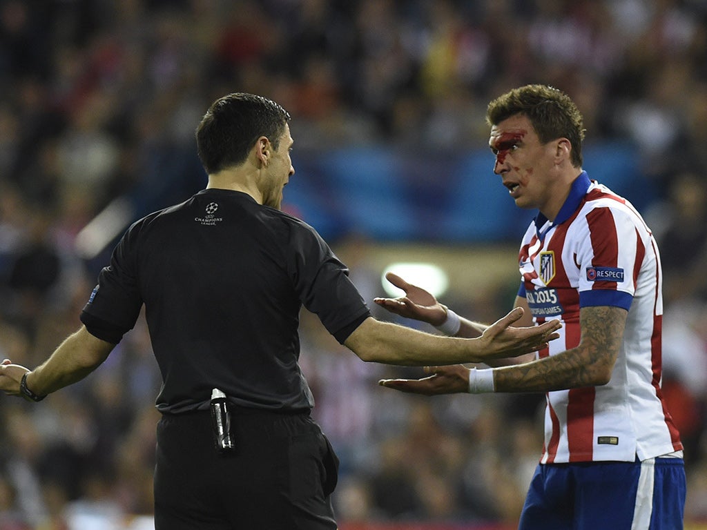 Mario Mandzukic was bloodied by a Sergio Ramos elbow