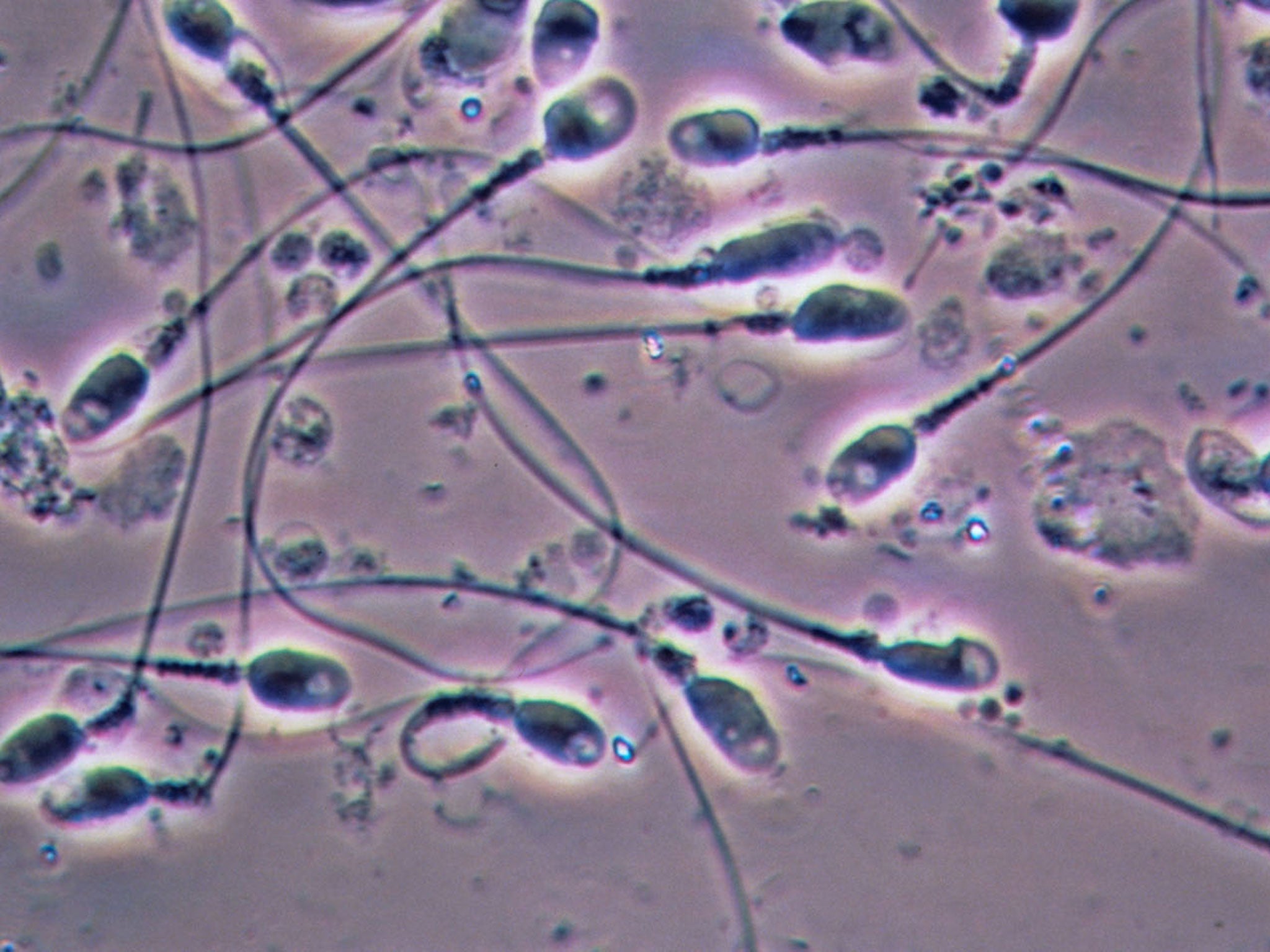 Sex stats: five litres of semen are produced in the UK each minute