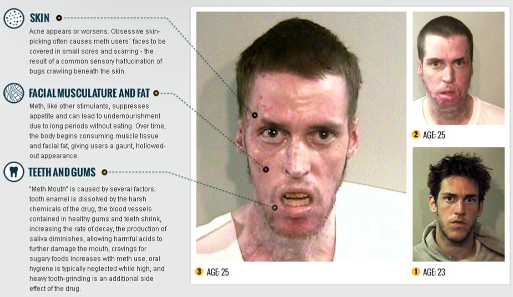 What methamphetamines does to users, from www.rehabs.com