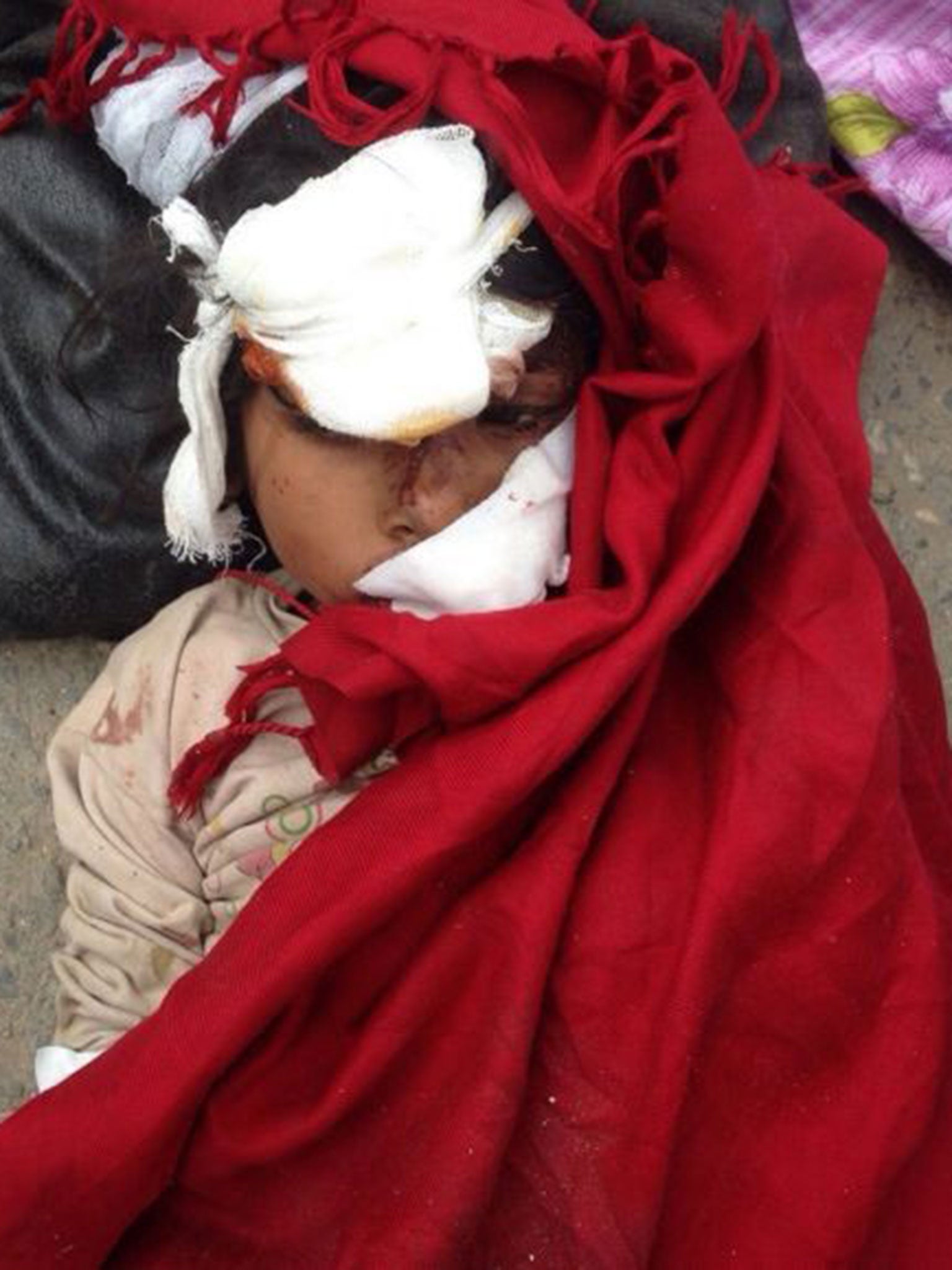 An injured child lies on the ground outside the Medicare Hospital in Kathmandu