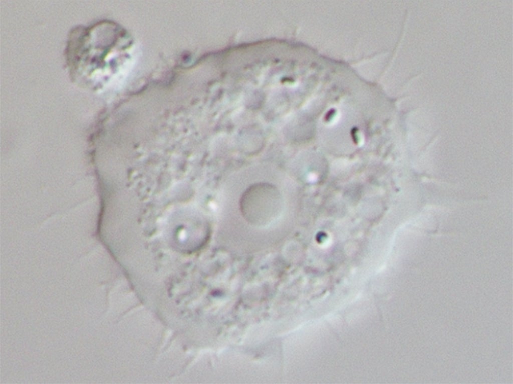 Acanthamoeba causing keratitis