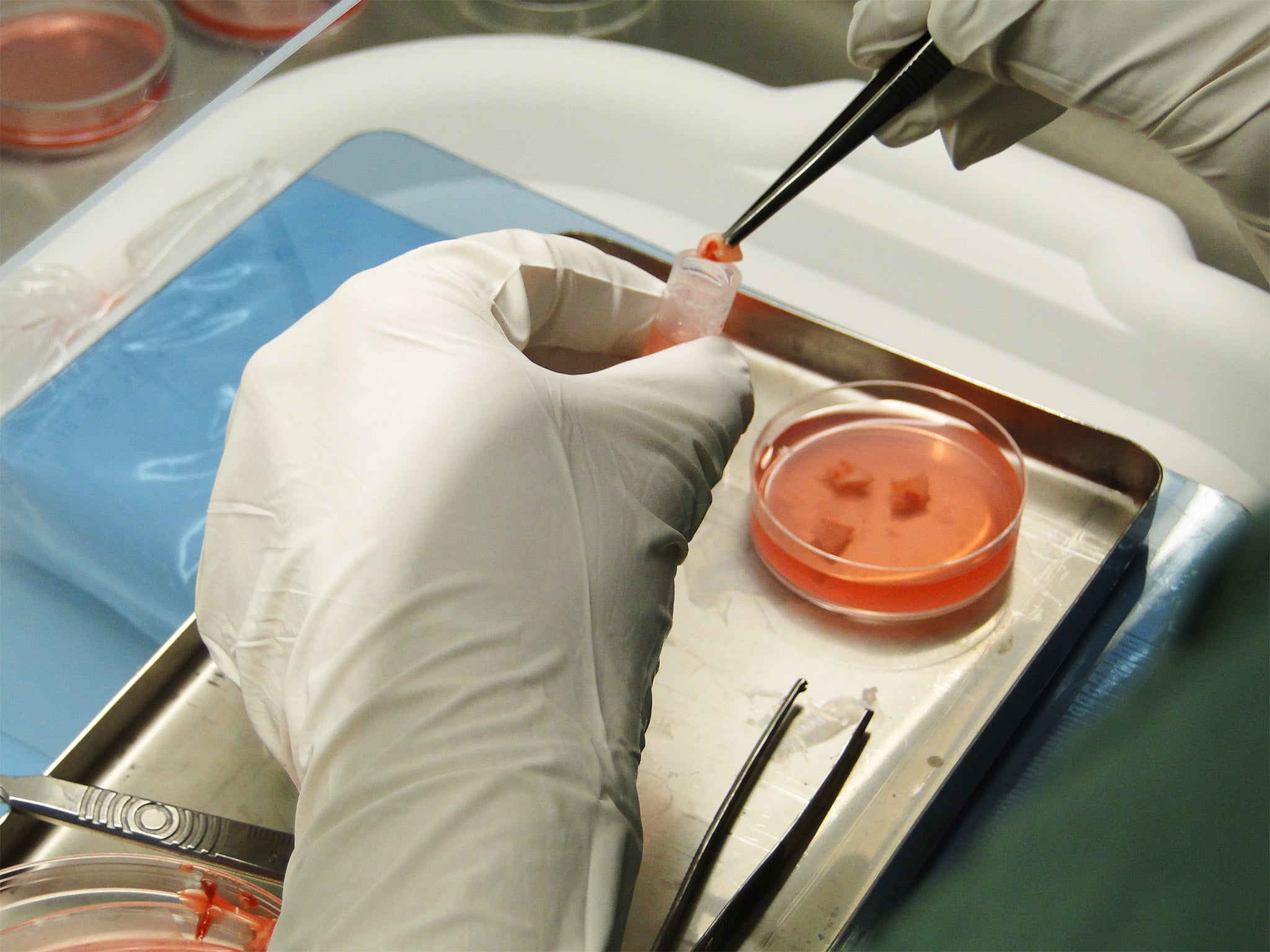 Ovarian tissue strips being placed into a preserving solution before being cryogenically frozen. File photo