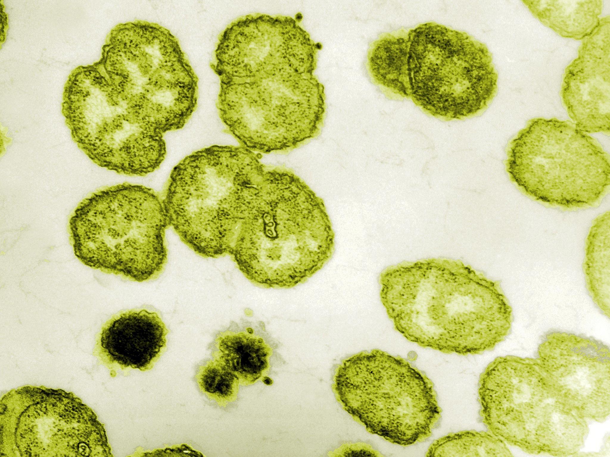 Public Health England has found 15 cases of the super resistant STD strain