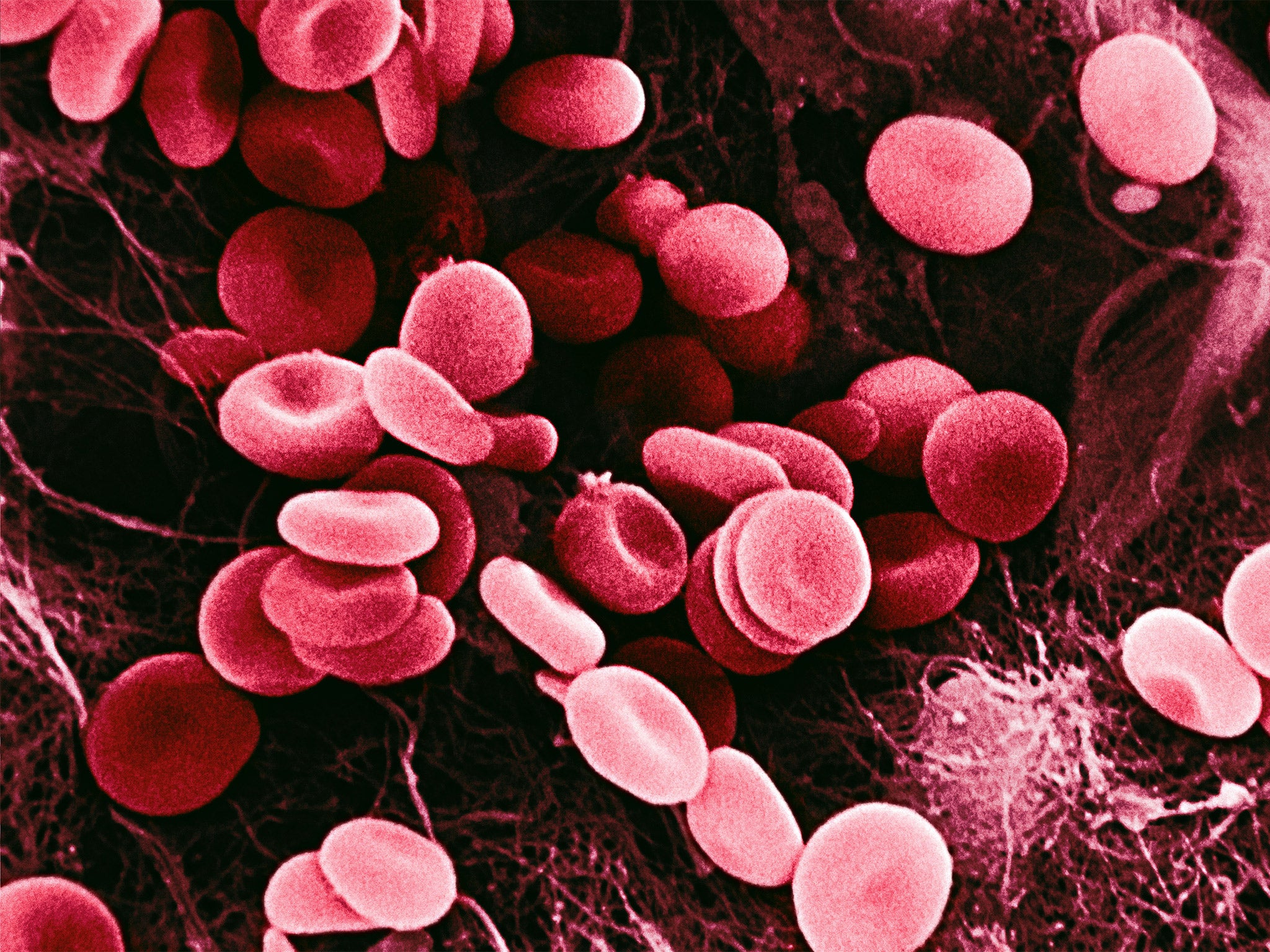 Red blood cells manufactured from stem cells have the advantage of being infection-free because they have never been inside the human body