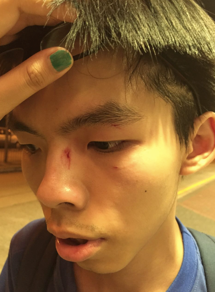 Joshua shows his injuries from the 'politically-motivated' attack