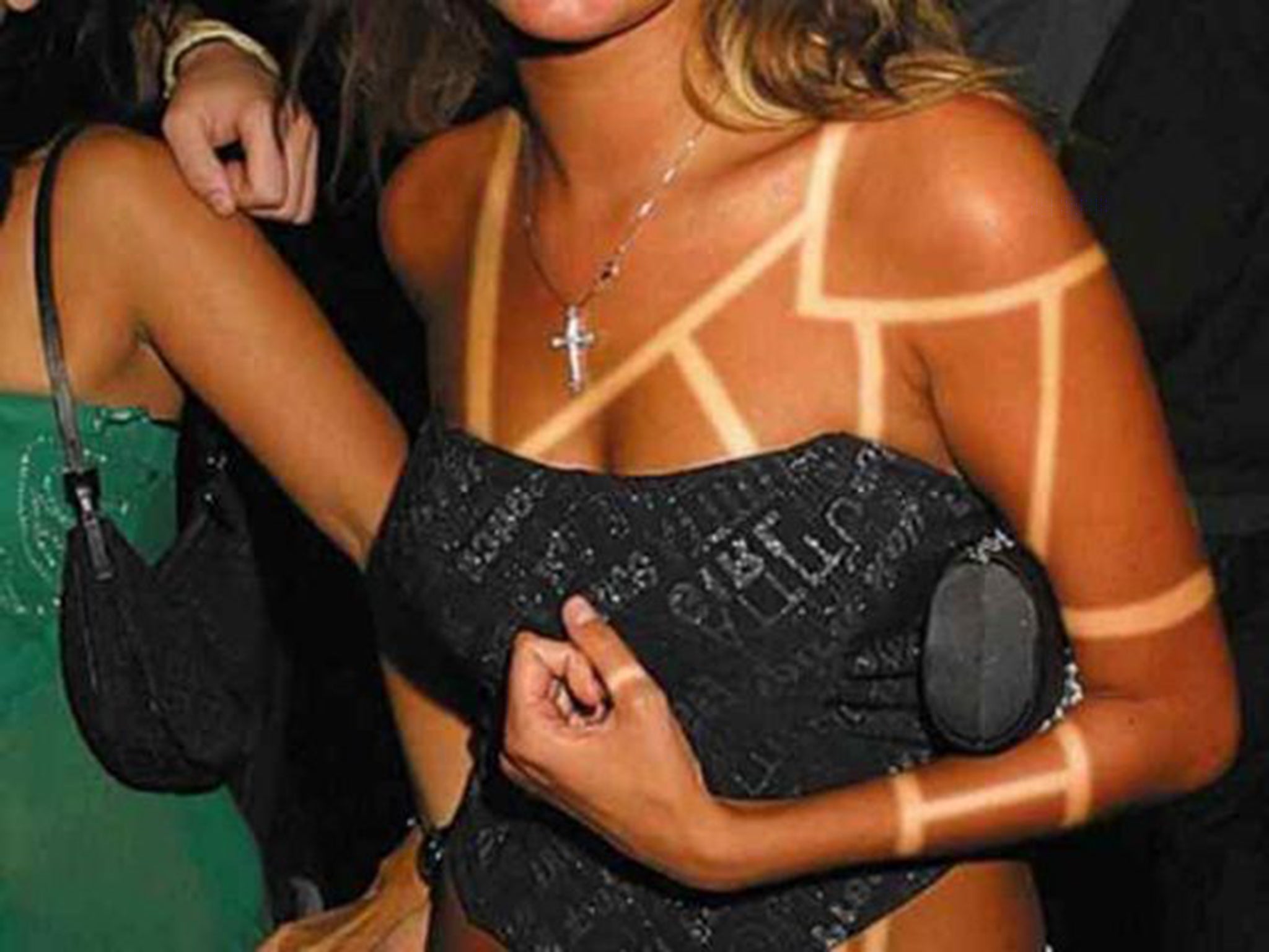 Sunburn art took the prize for the stupidest social media fashion last week