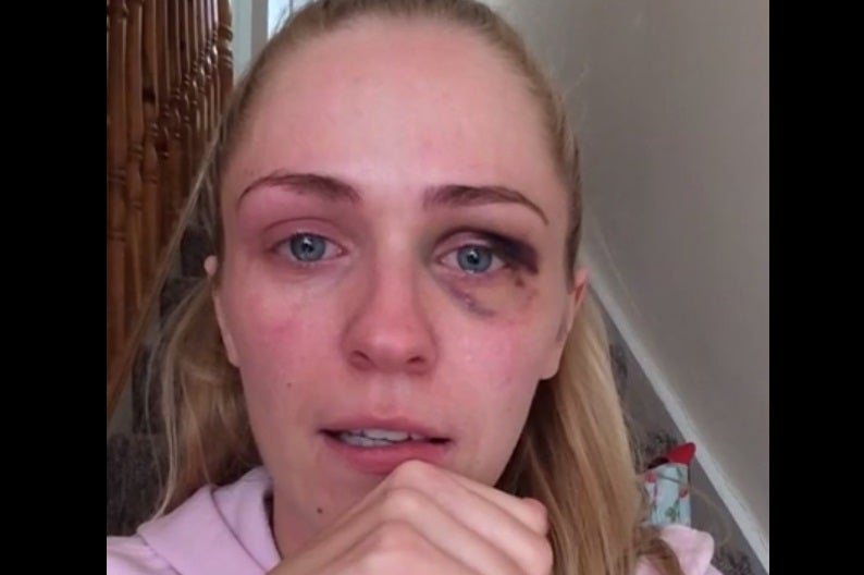 Emma Murphy, 26, made the video