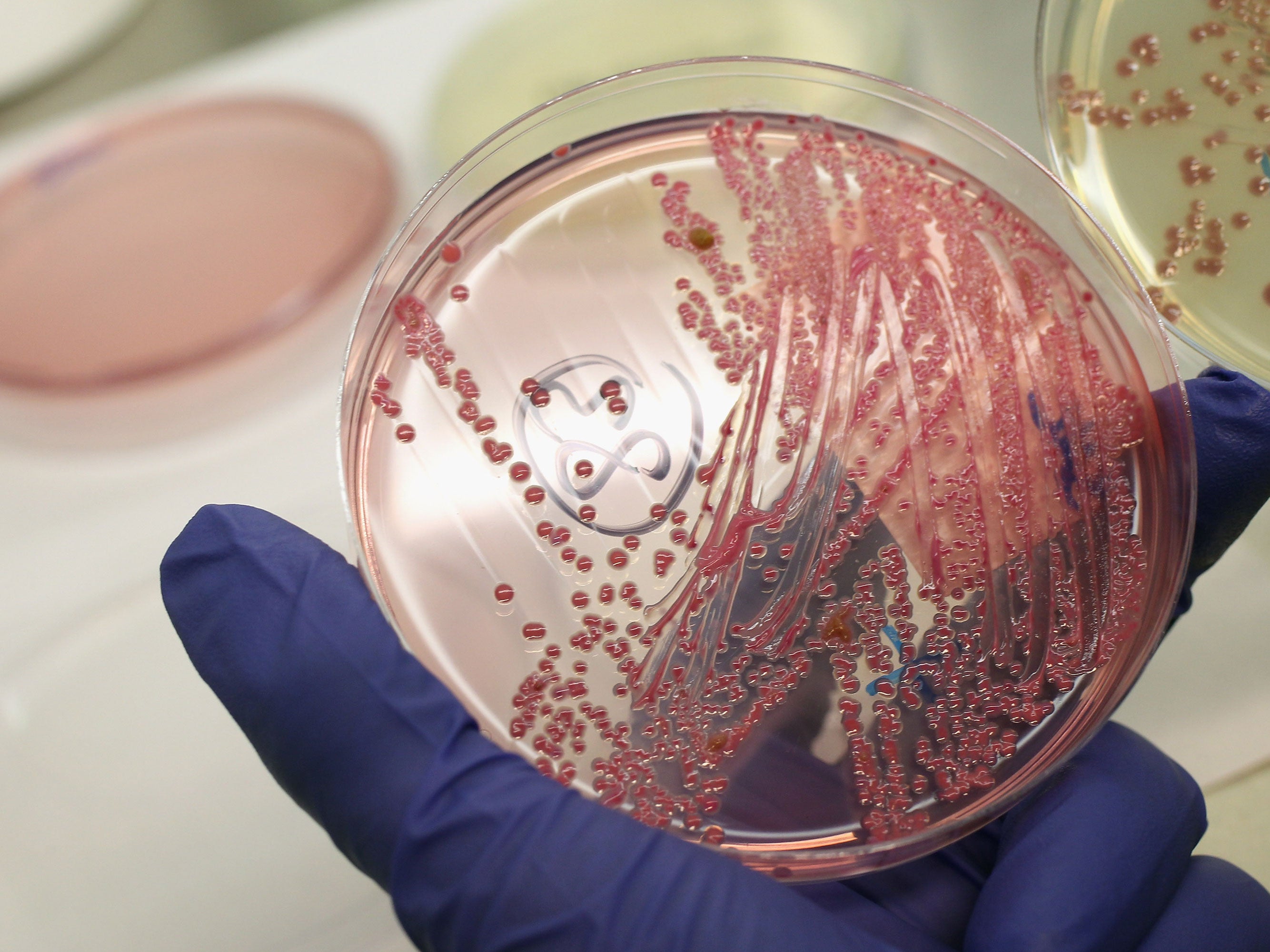 The new strain of group A streptococcus could be more likely to cause severe internal infections