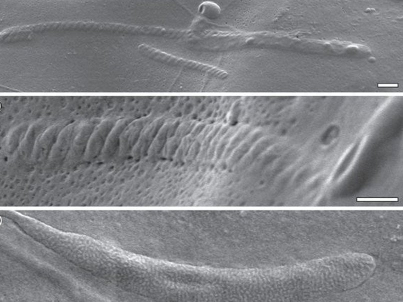 50 million year old sperm fragments encased in a fossilised cacoon, shown by scientists at the Natural History Museum in Stockholm