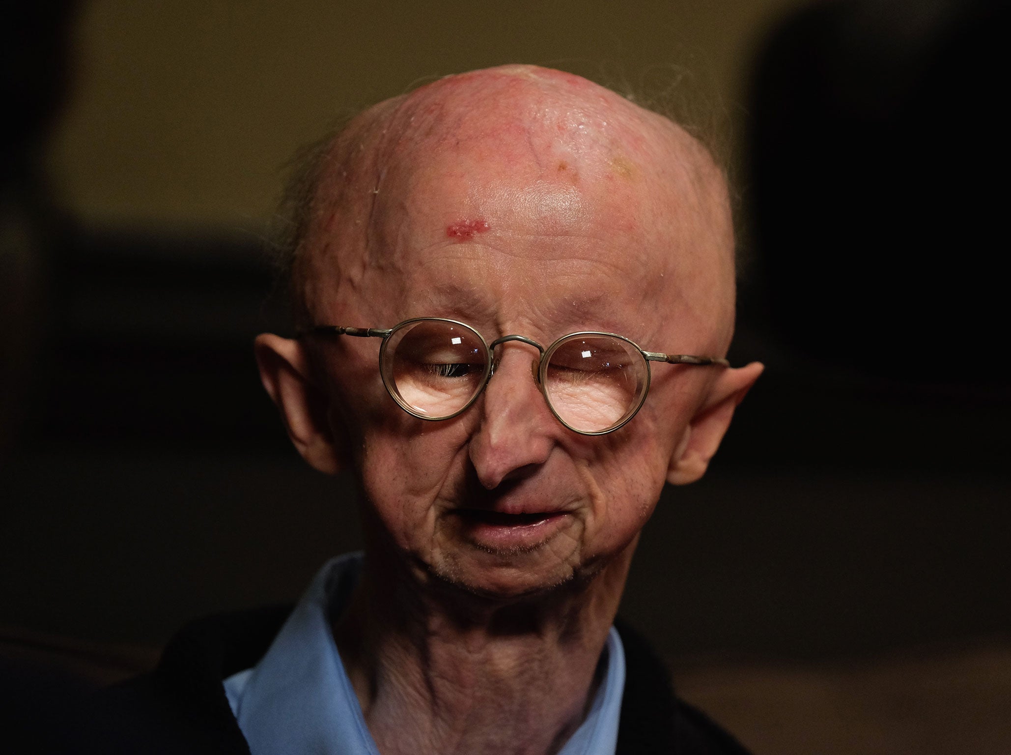 Alan Barnes, who was the victim of an assault outside his home. (Ian Forsyth/Getty)