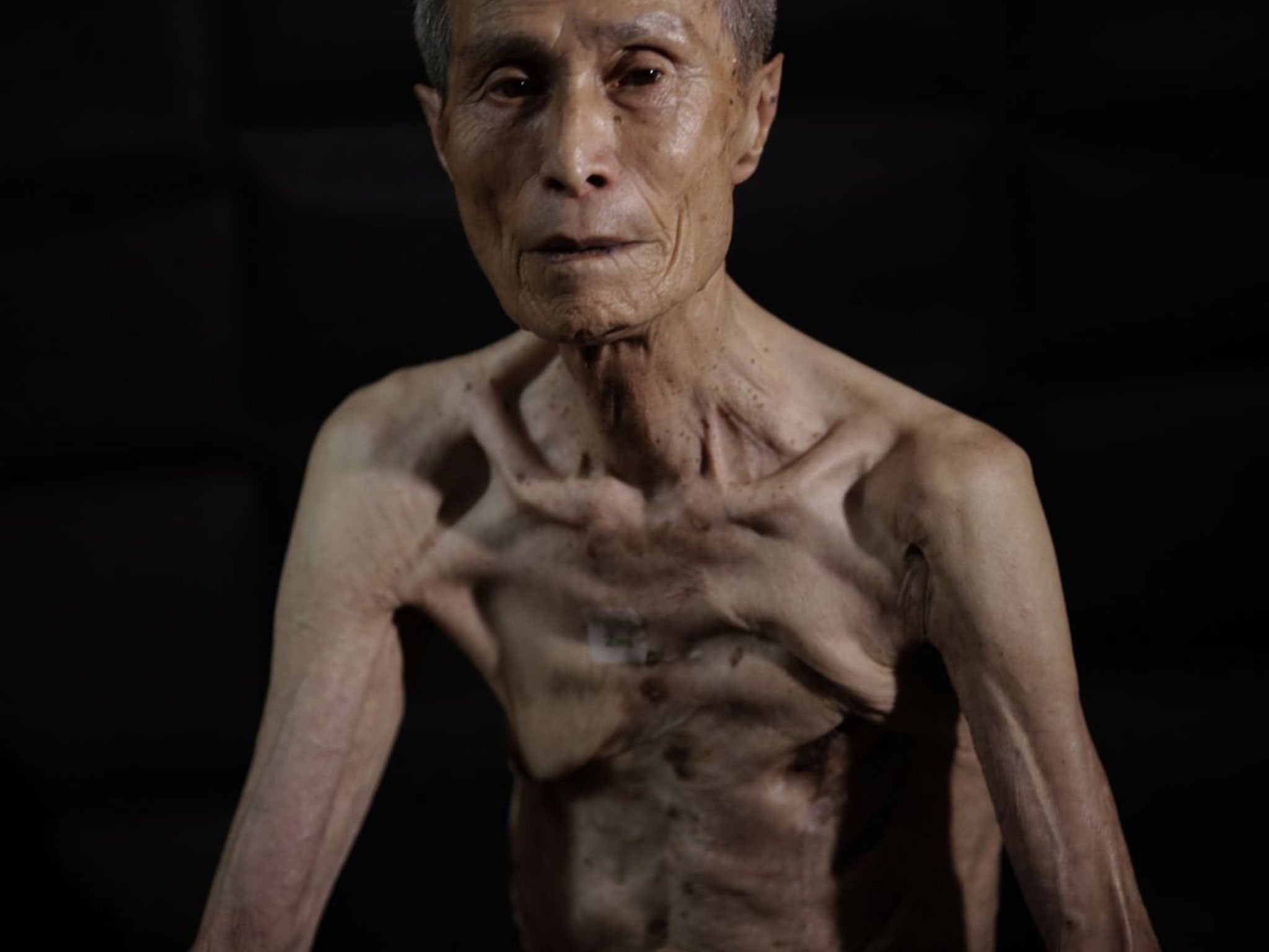 Sumiteru was 16 years old when the bomb blast threw him off his bicycle