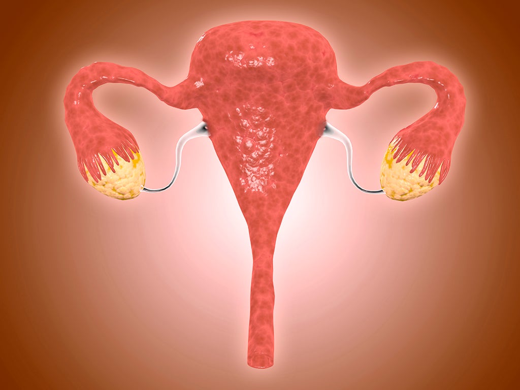 Anatomy of female uterus with ovaries.